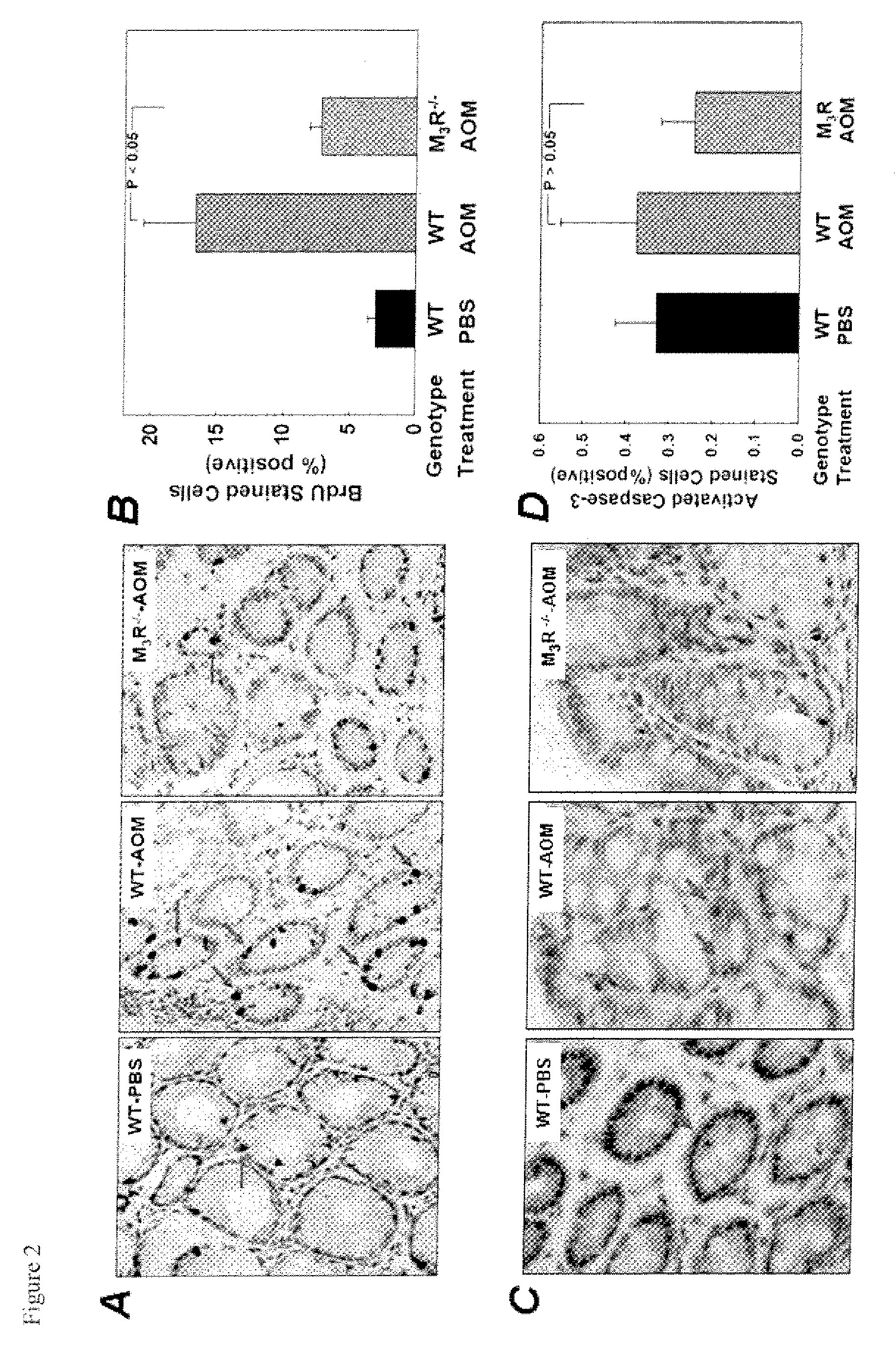 Treatment of cancer with Anti-muscarinic receptor agents