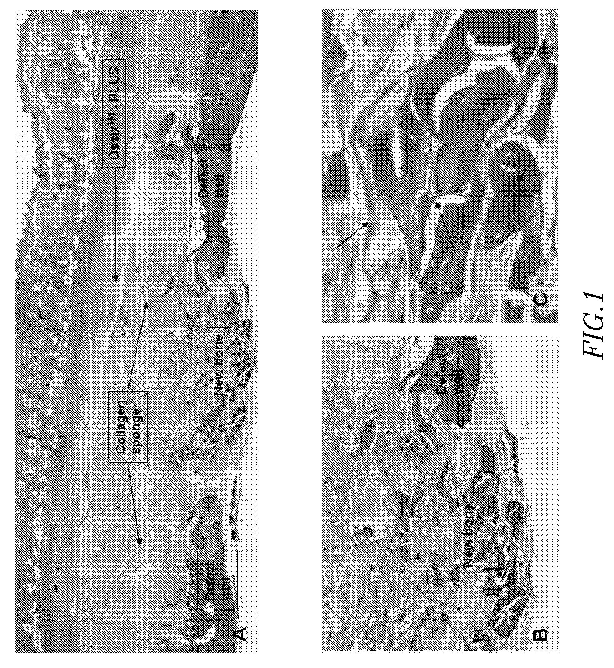 Composite implants for promoting bone regeneration and augmentation and methods for their preparation and use