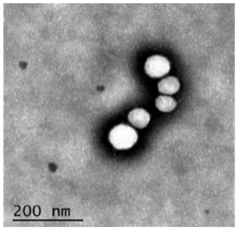 An active targeting ultrasound/fluorescence dual-mode contrast agent and its preparation method and application