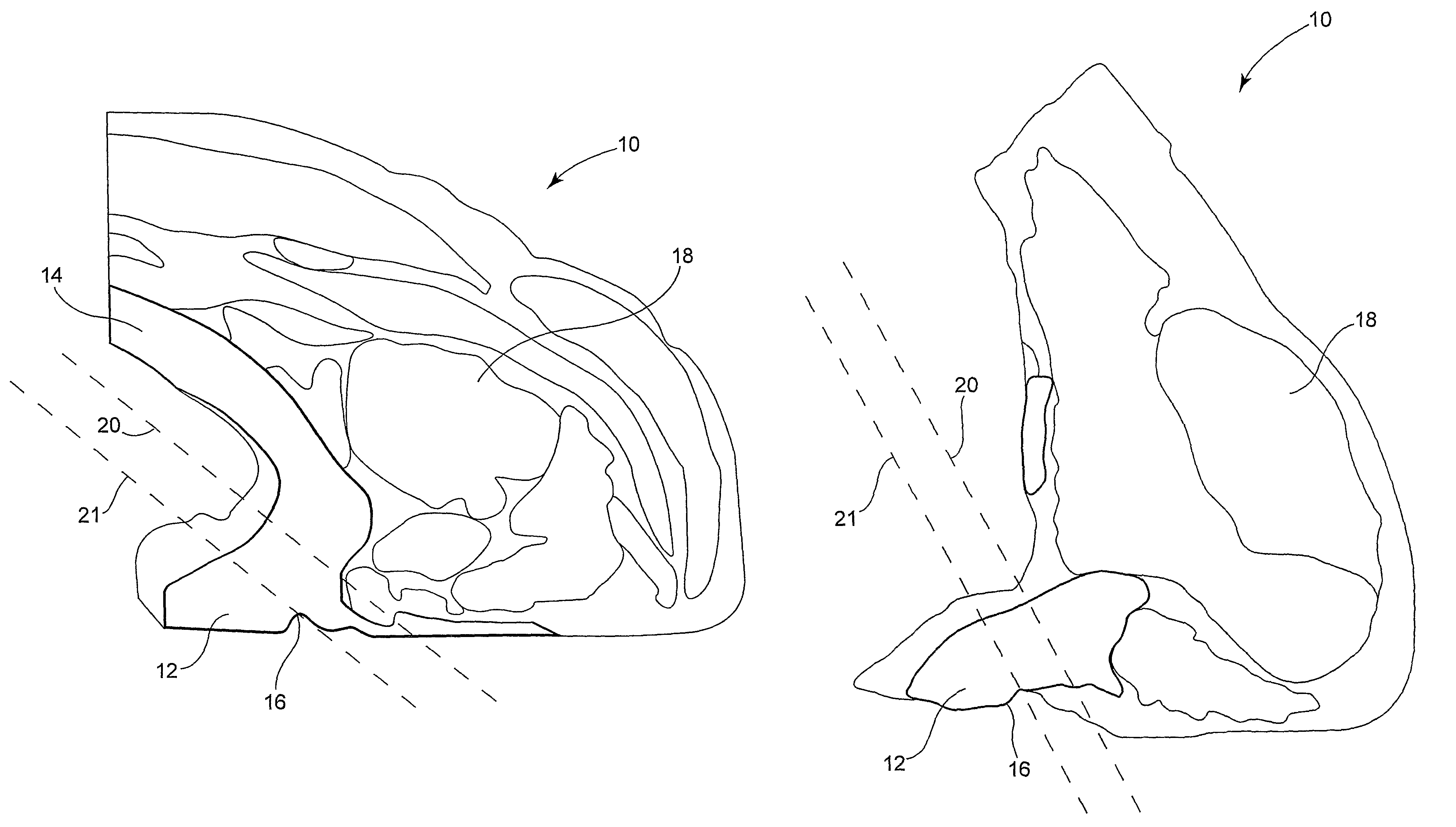 Meat fabrication system and method