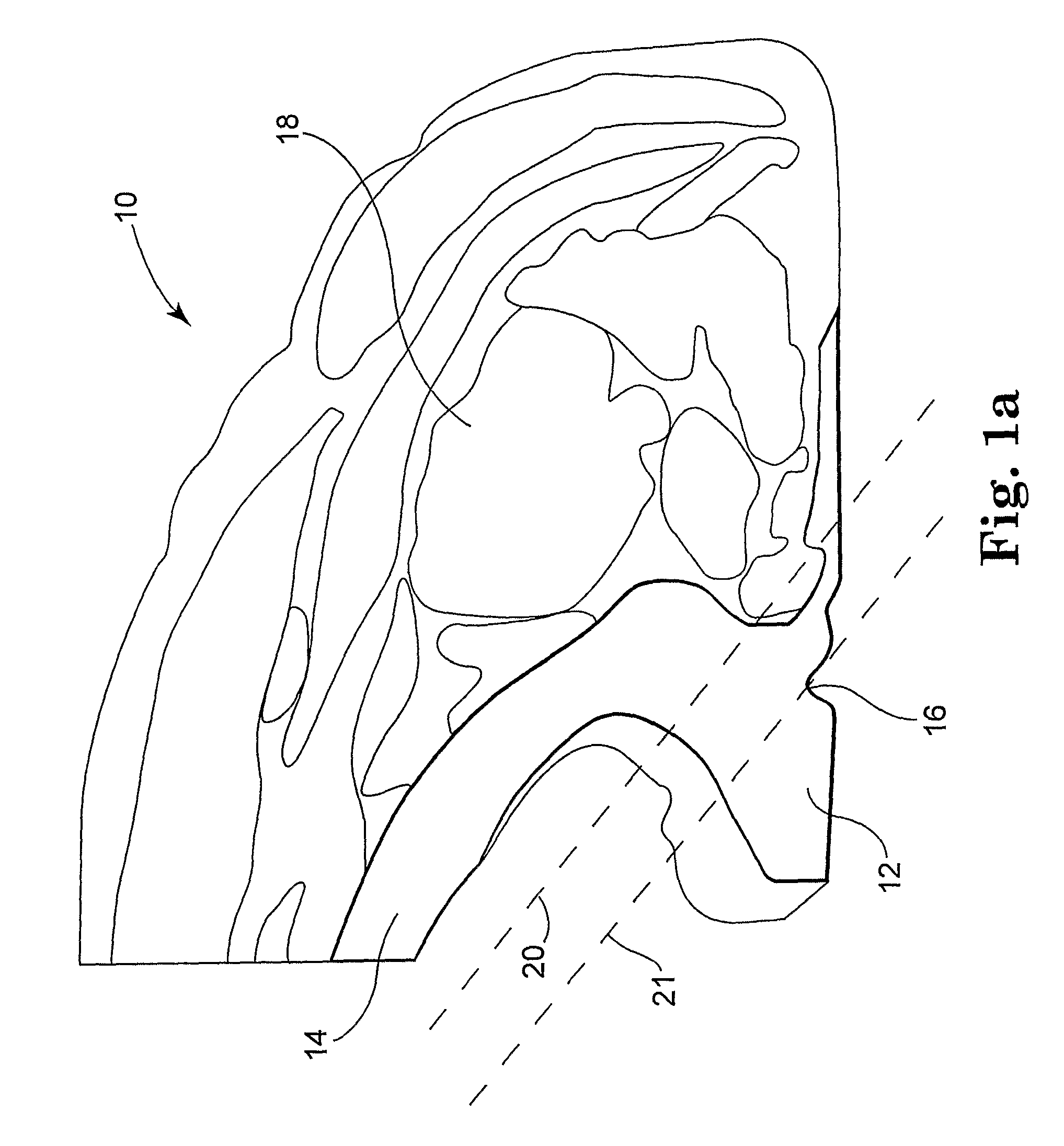 Meat fabrication system and method