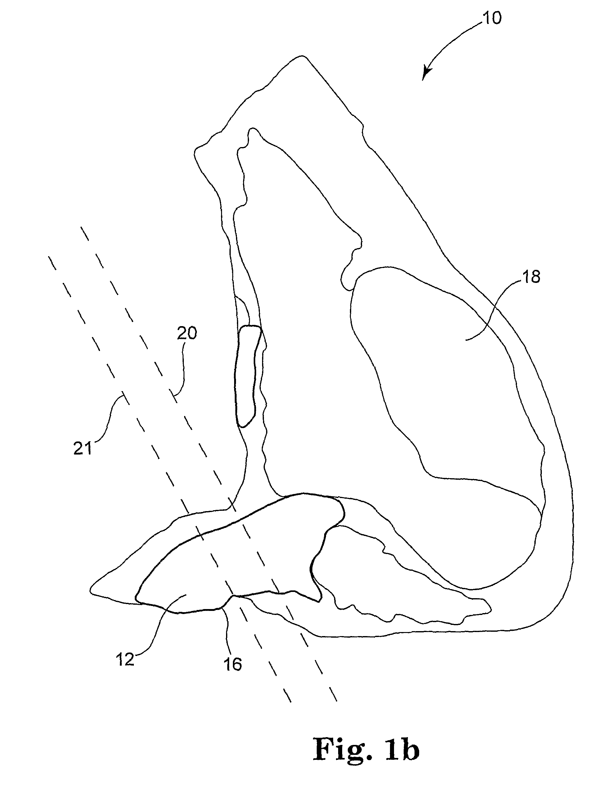 Meat fabrication system and method