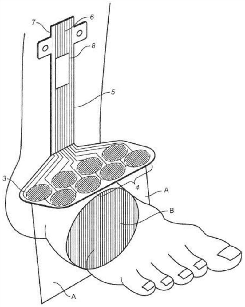 Wearable footwear sensor arrays for detection of cardiac events, body motion, and muscular actions