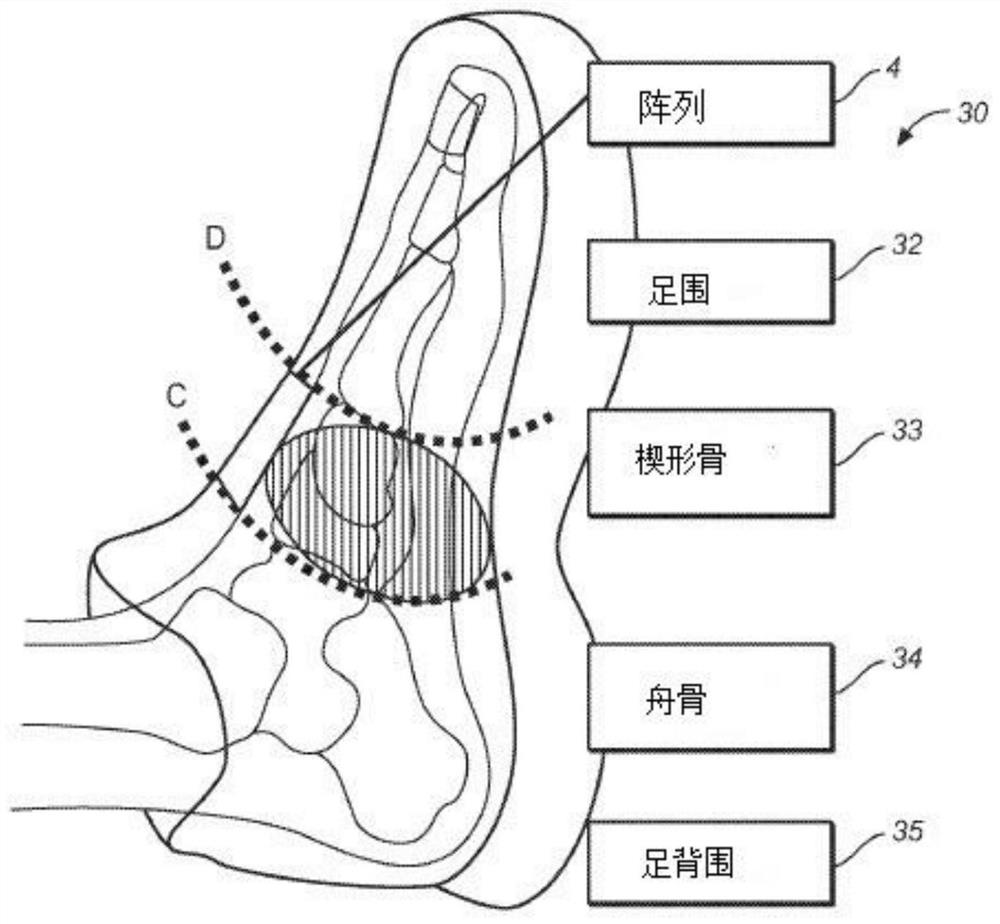 Wearable footwear sensor arrays for detection of cardiac events, body motion, and muscular actions