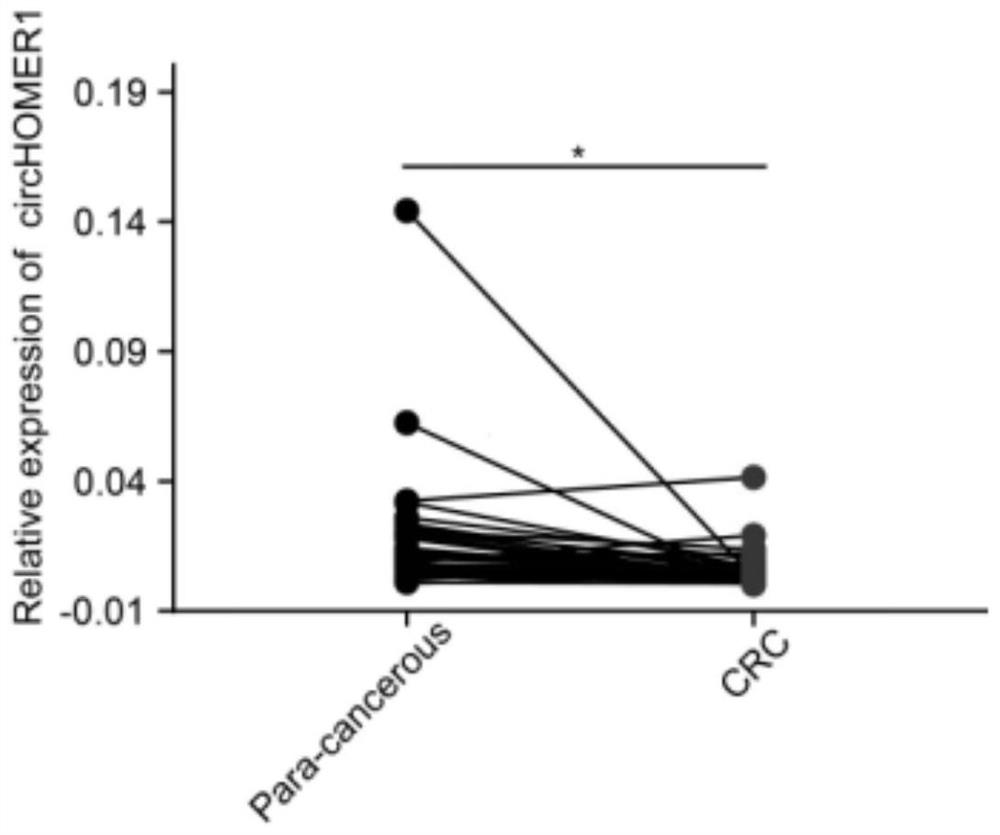 Application of CircHOMER1 and colorectal cancer treatment preparation