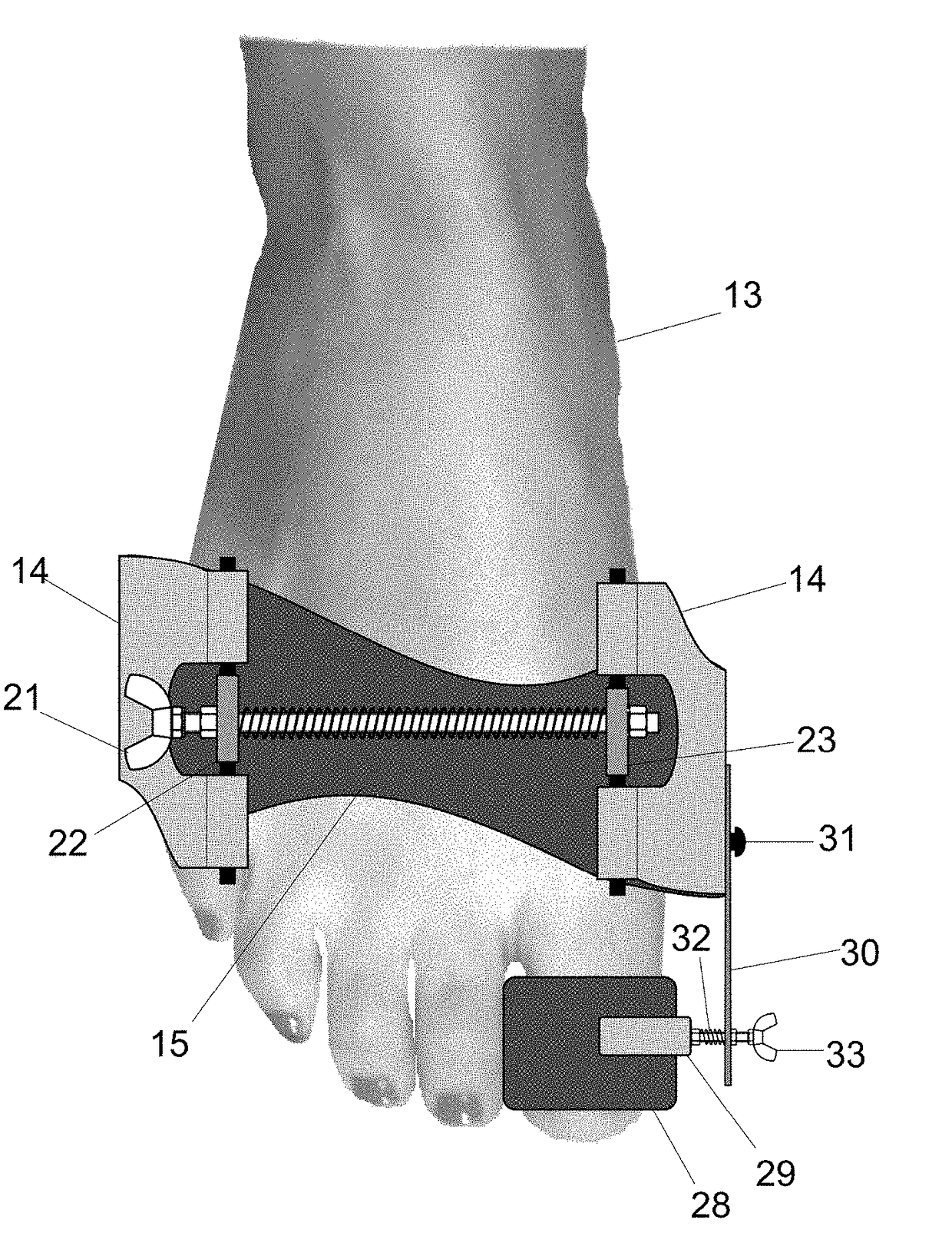 Foot orthosis with comprehensive method for correcting deformities of the transverse arch of the foot in cases of static transverse flatfoot compounded by hallux valgus, with possible preventive and post-operative applications.