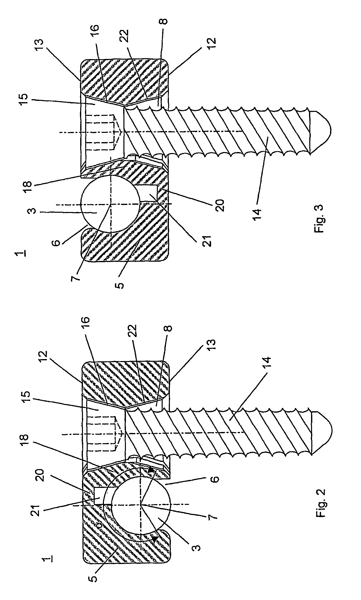 Angularly stable device for mutually fixing a longitudinal carrier with a bone fixation element