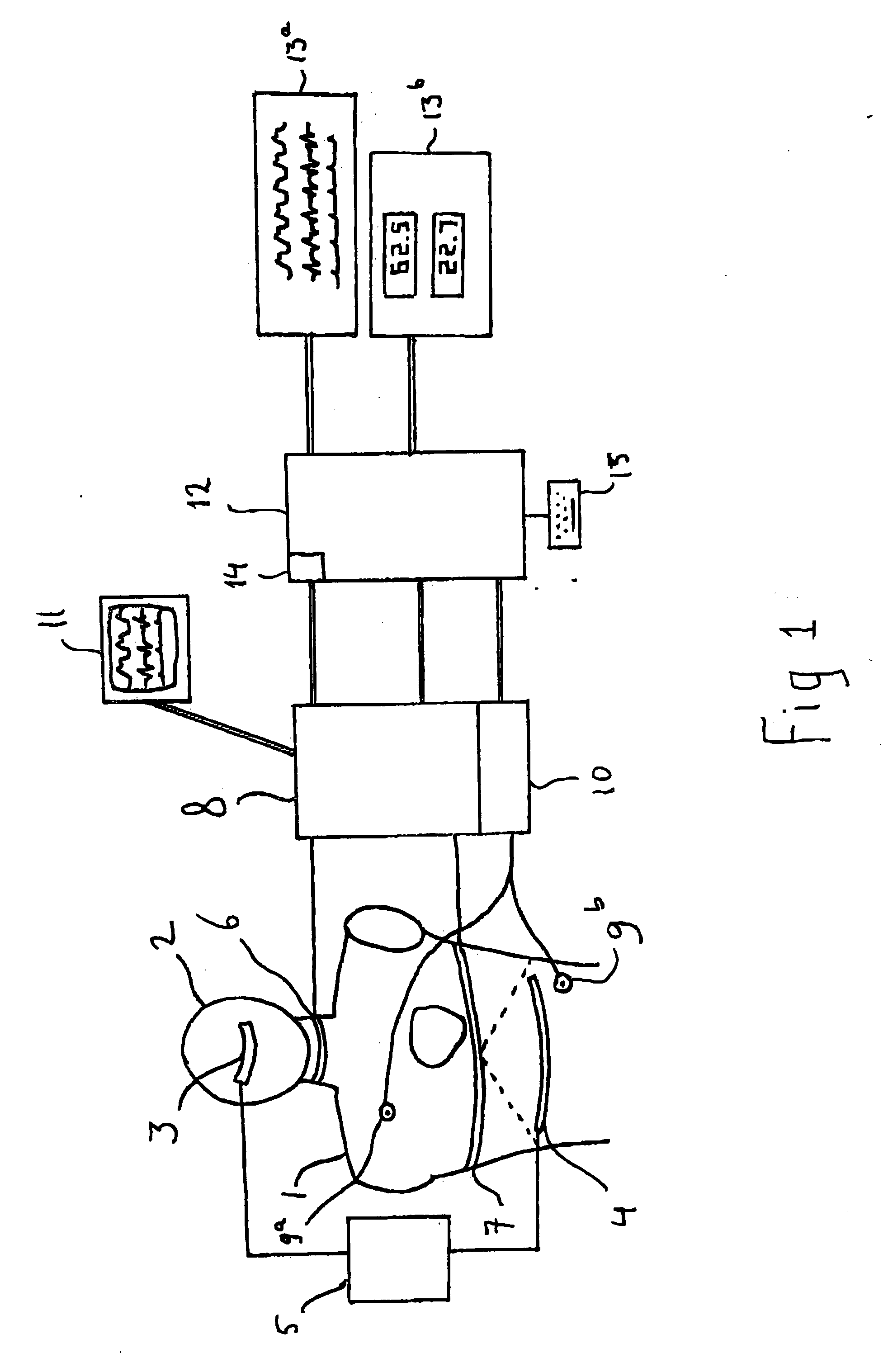 Device and method for determining coronary blood flow
