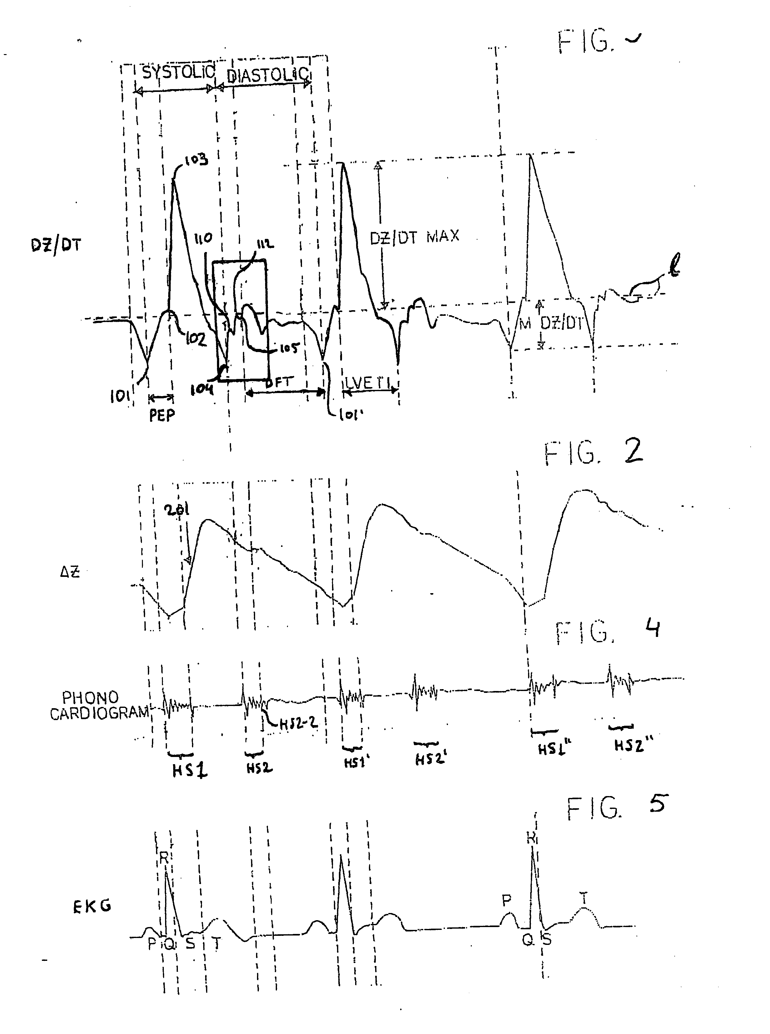 Device and method for determining coronary blood flow
