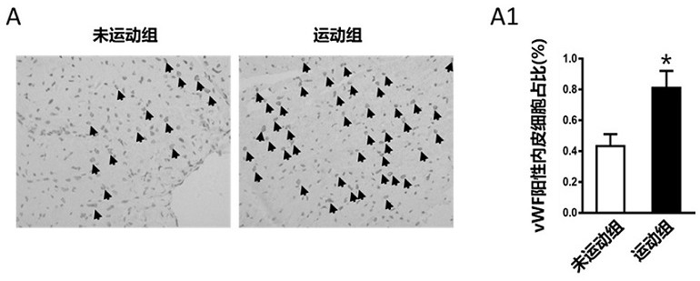 Application of Ctrp15 in preparation of products for promoting angiogenesis and improving ischemia-related cardiac functions