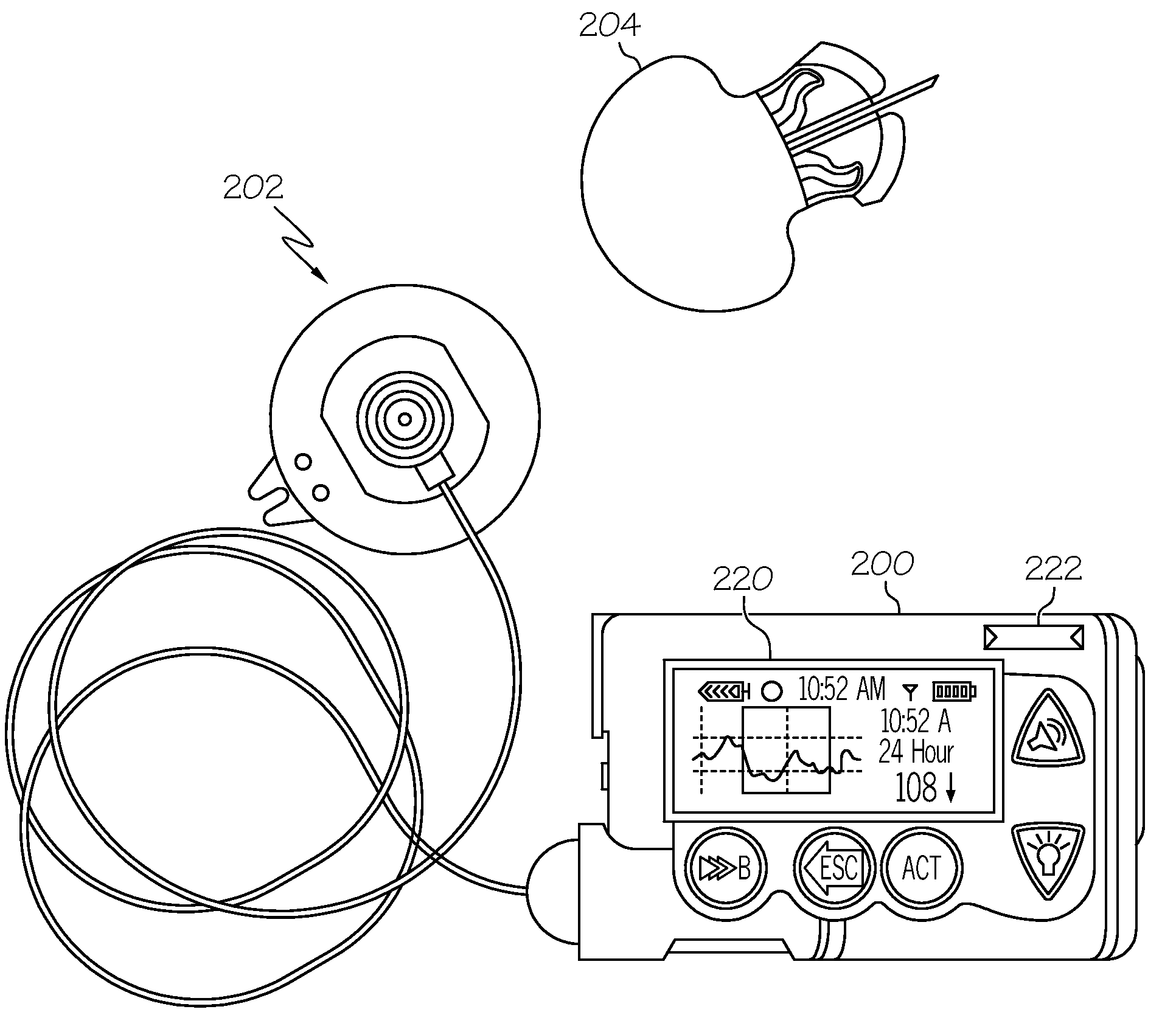 Coordination of control commands in a medical device system having at least one therapy delivery device and at least one wireless controller device