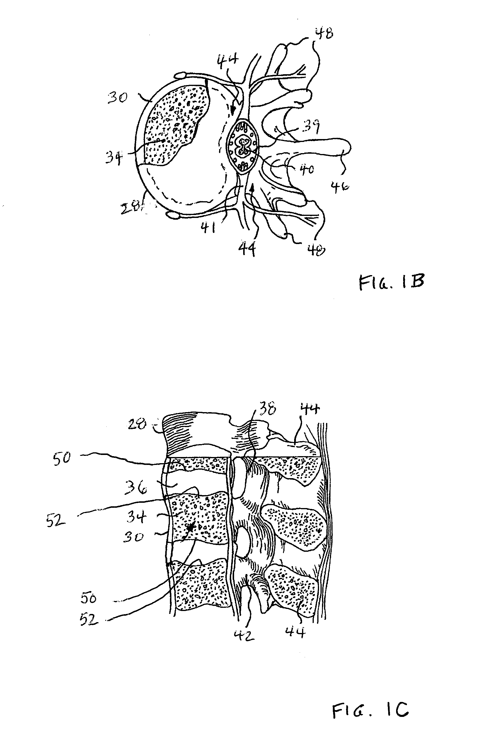 Preparation Tools and Methods of Using the Same