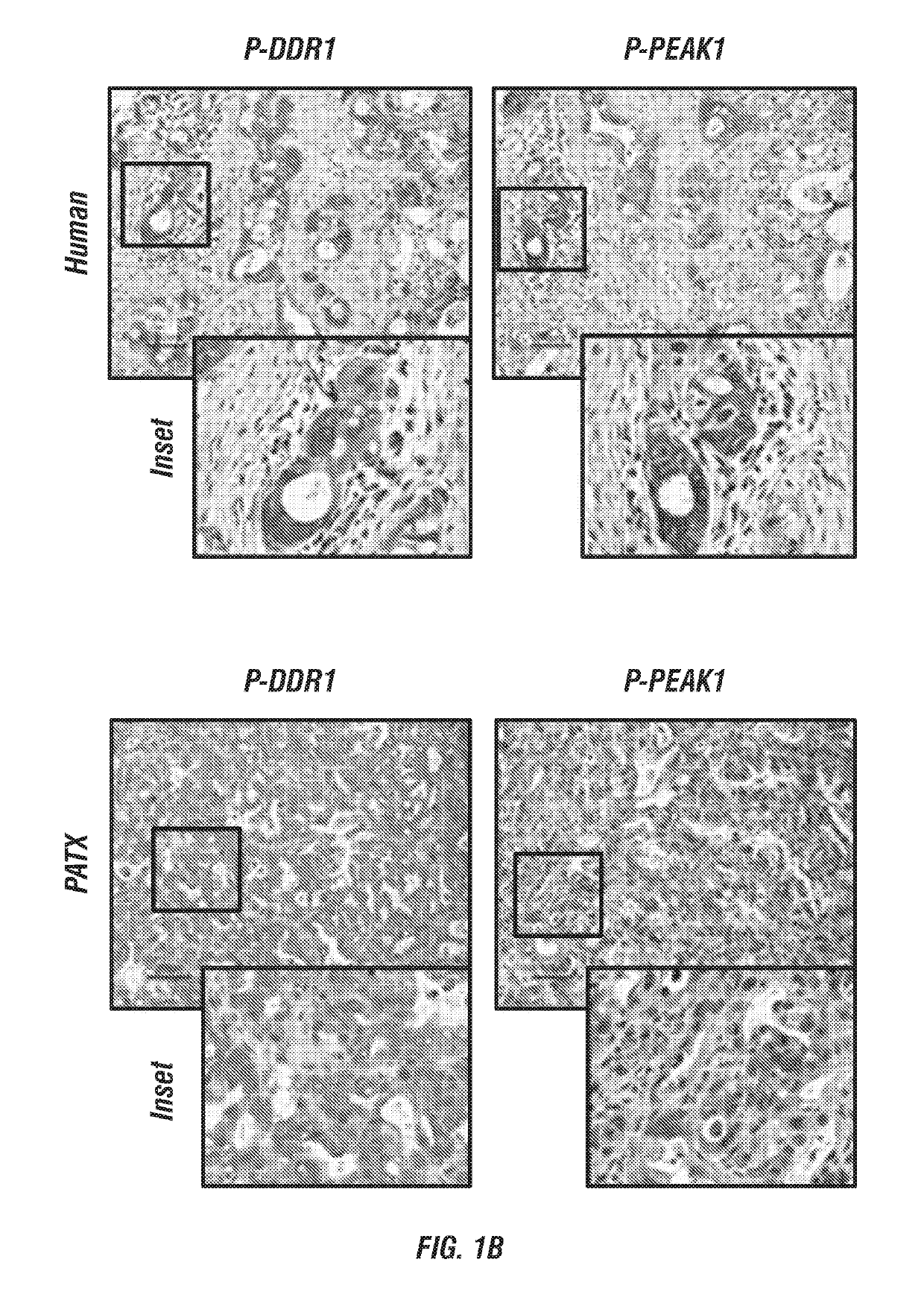 Small-molecule inhibitors targeting discoidin domain receptor 1 and uses thereof