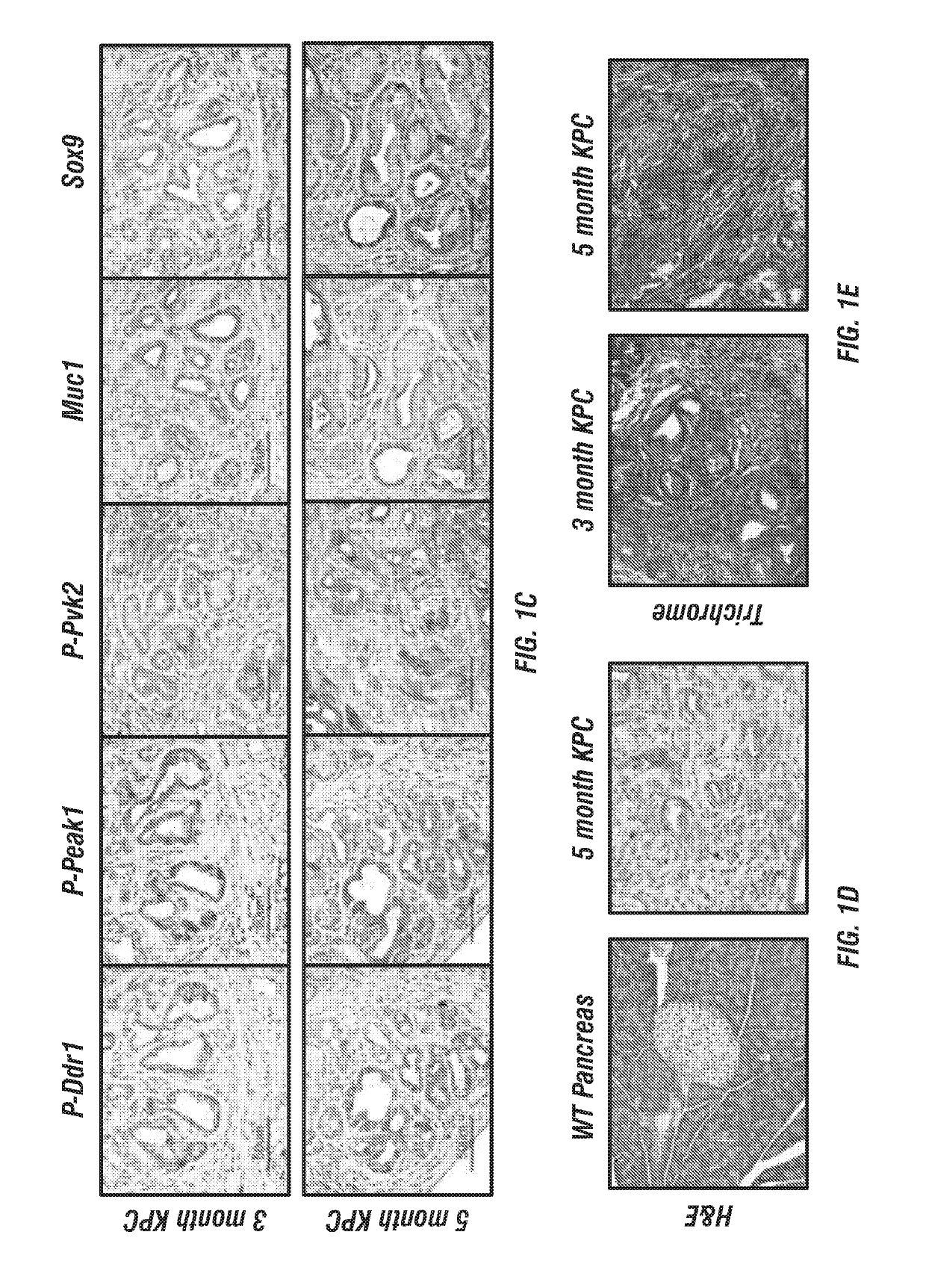 Small-molecule inhibitors targeting discoidin domain receptor 1 and uses thereof