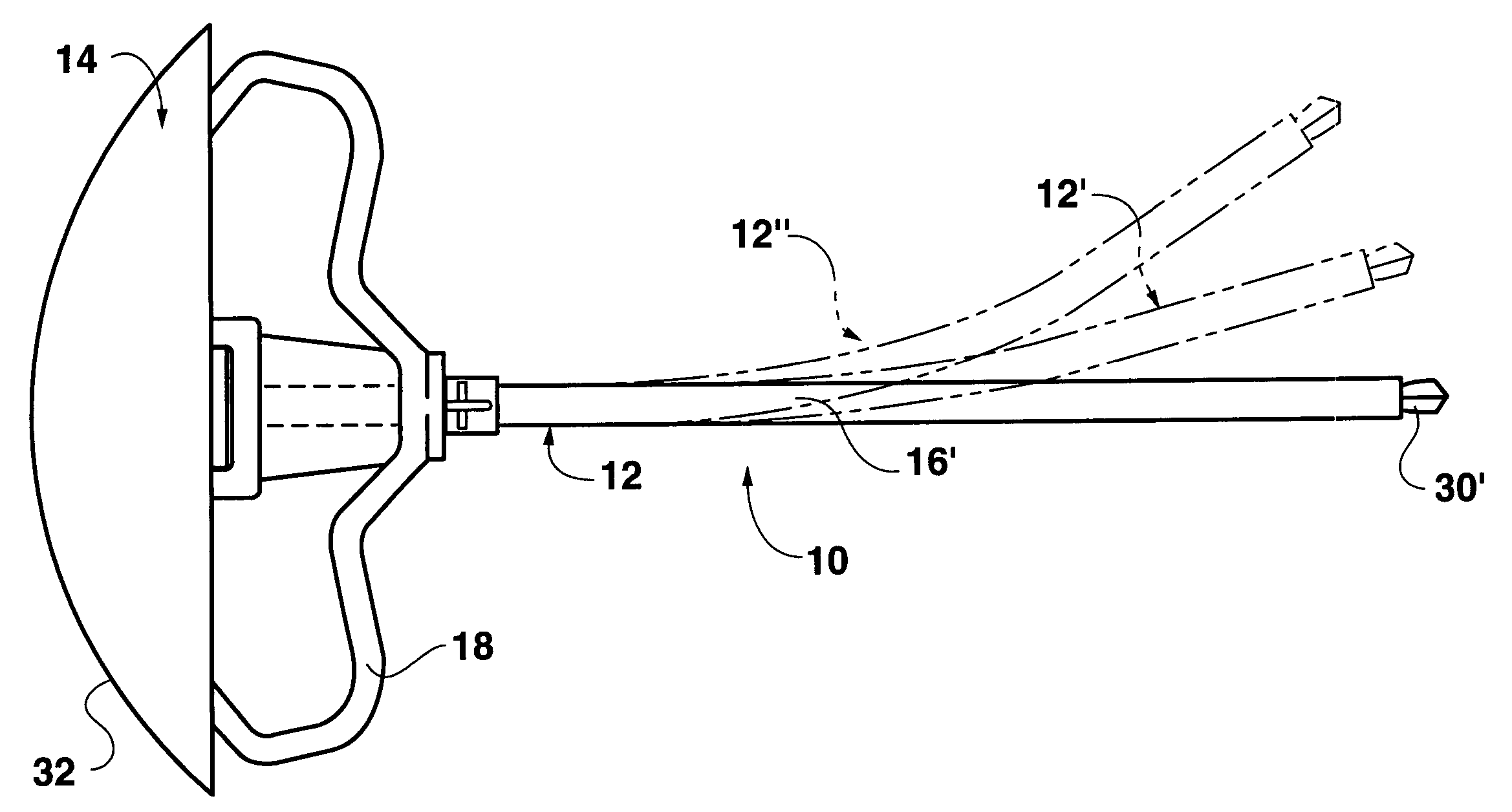 Bendable needle for delivering bone graft material and method of use