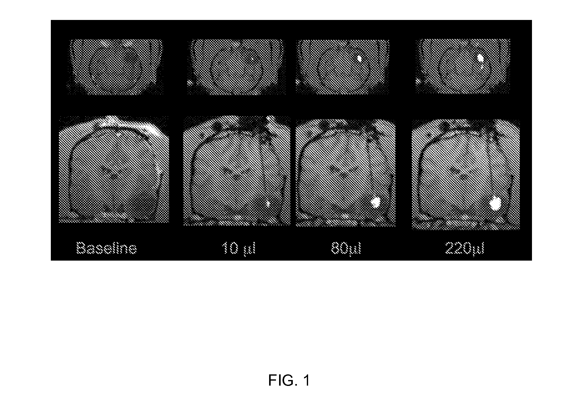 Compositions and methods for convection enhanced delivery of high molecular weight neurotherapeutics