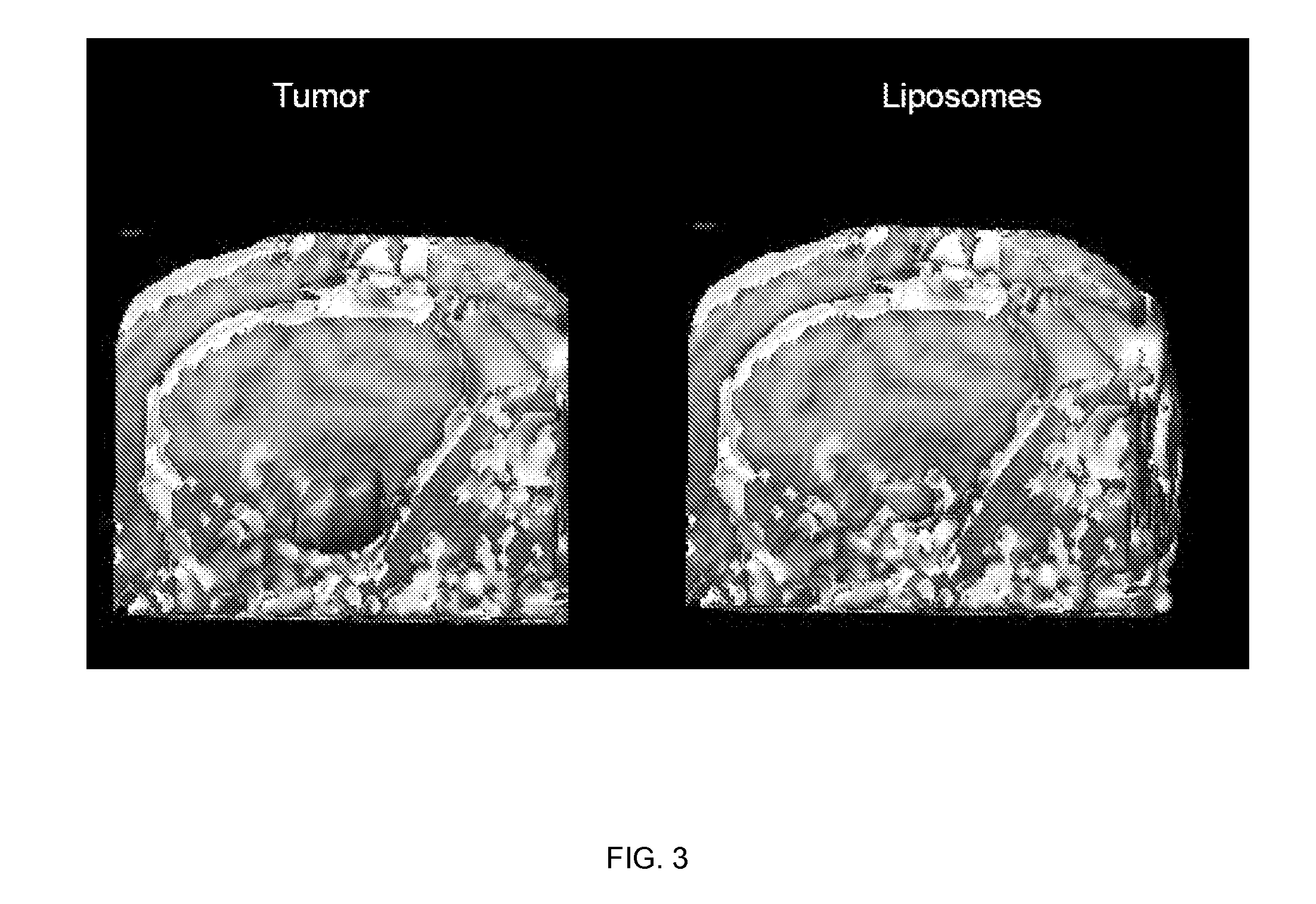 Compositions and methods for convection enhanced delivery of high molecular weight neurotherapeutics