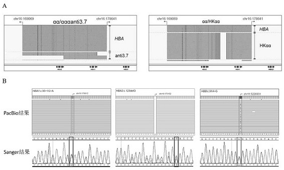 Method and kit for simultaneously detecting multiple mutations at hba1/2 and hbb gene loci