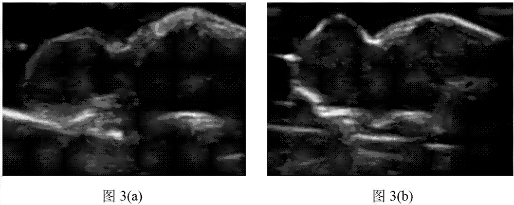 Feature extraction method for ultrasound tissue characterization based on Hilbert-Huang transform