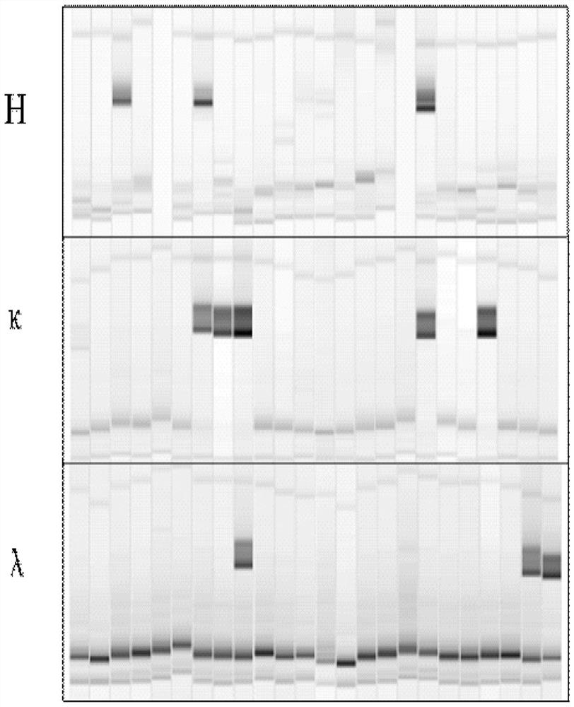 Humanized antibody combined with tetanus toxin heavy chain C-terminal structural domain and application