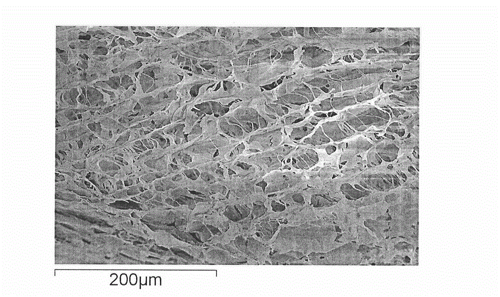 Cardiac muscle tissue engineering product and its preparation method and use