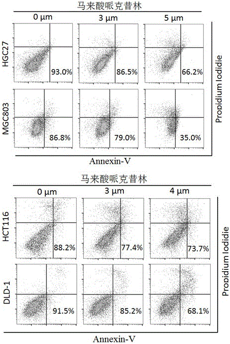 Application of perhexiline in treating stomach cancers and intestinal cancers