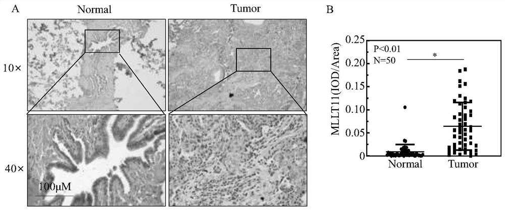 Target MLLT11 for preventing lung cancer and application thereof