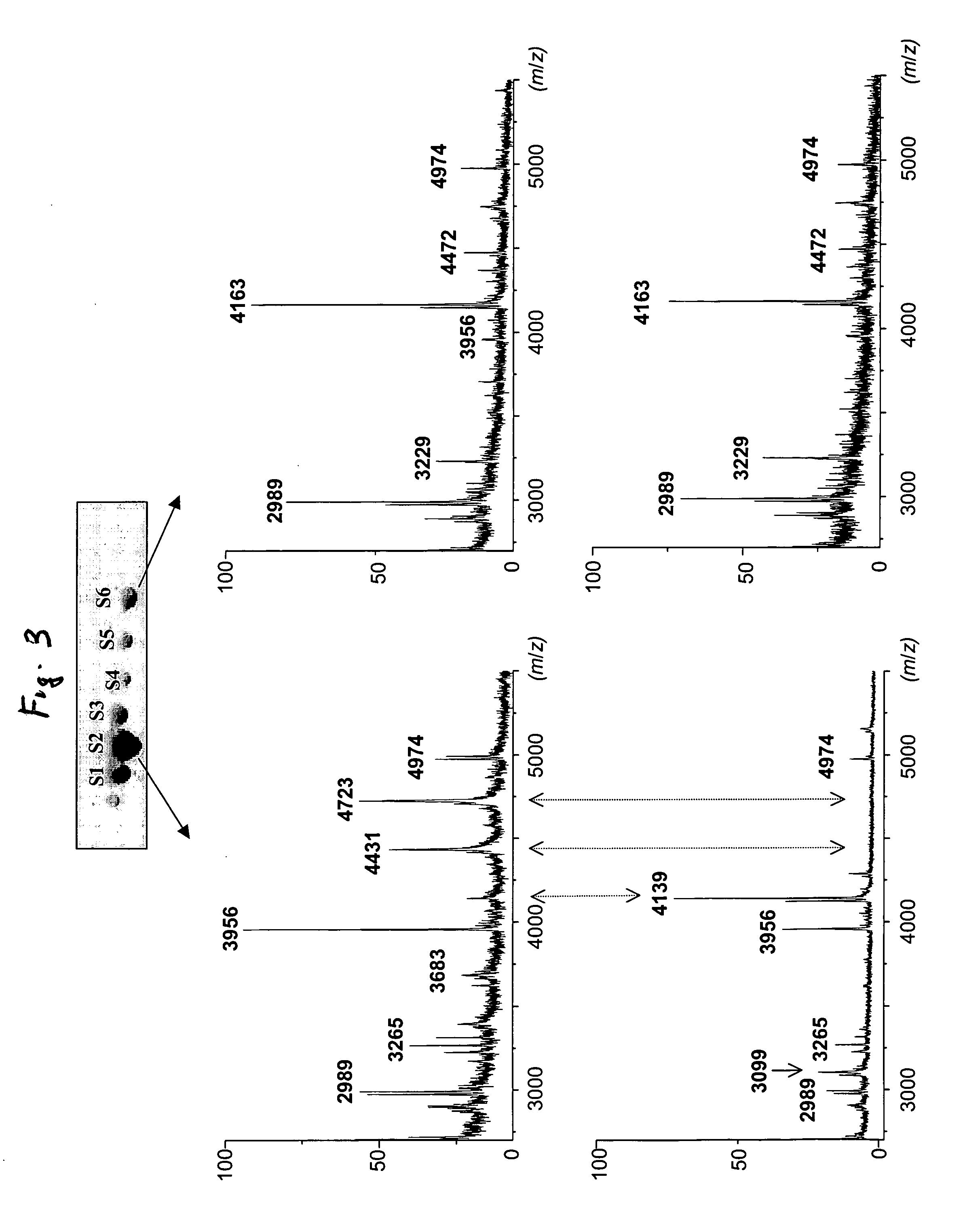 Biochemical marker for diagnosing a leukodystrophy