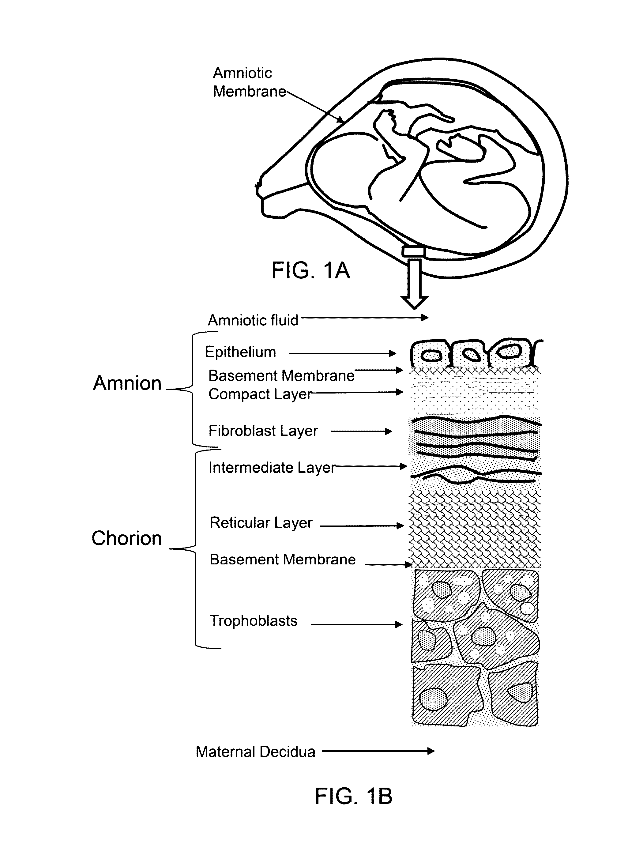 Amnion derived therapeutic compositions and methods of use
