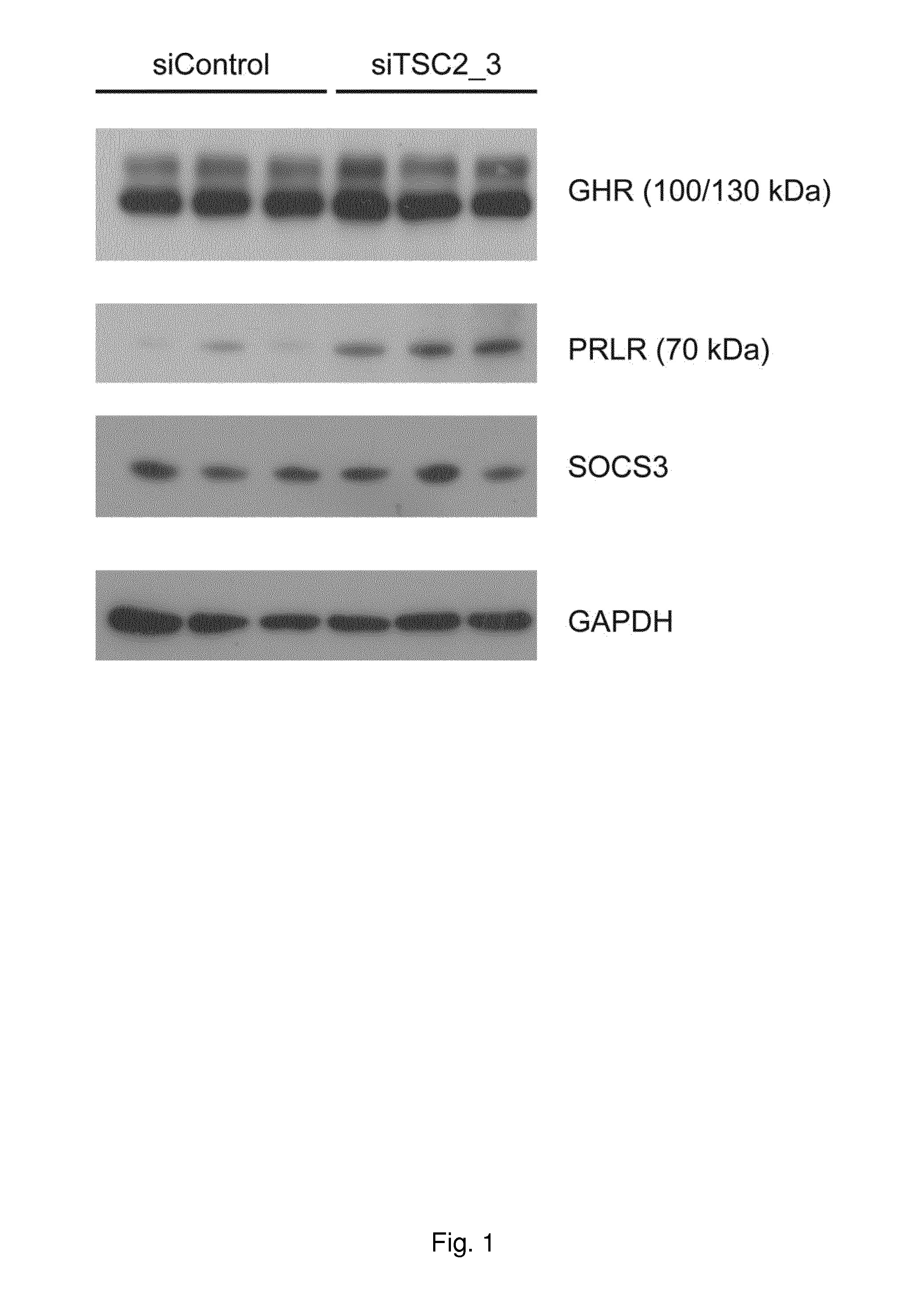 Method for diagnosis and treatment of prolactin associated disorders
