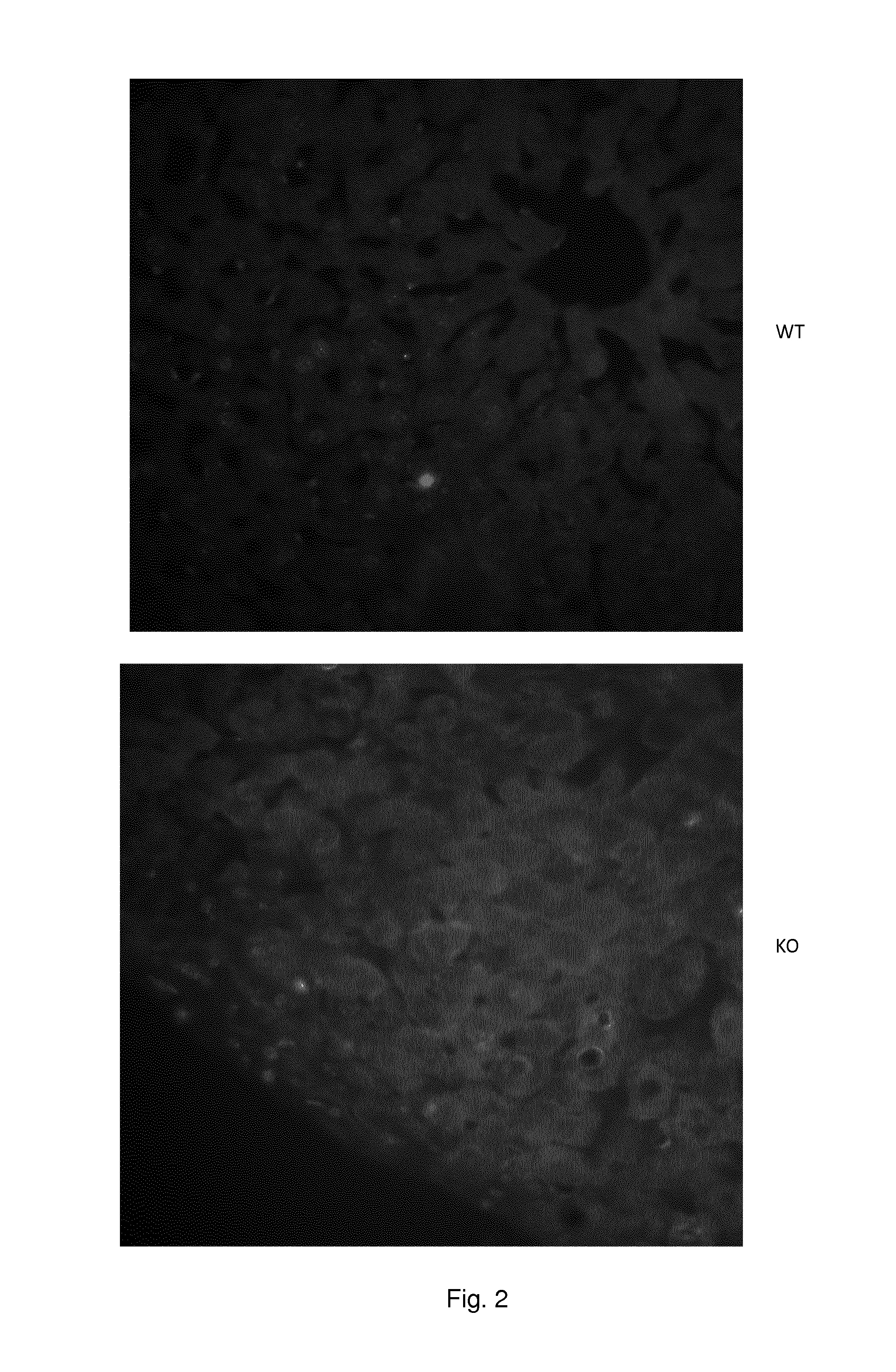 Method for diagnosis and treatment of prolactin associated disorders