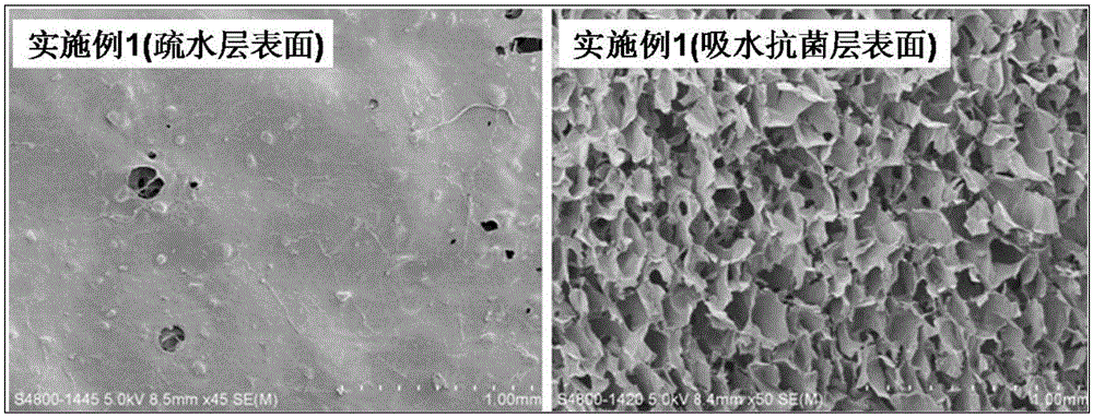A kind of chitosan-nanometer silver wound dressing and preparation method thereof