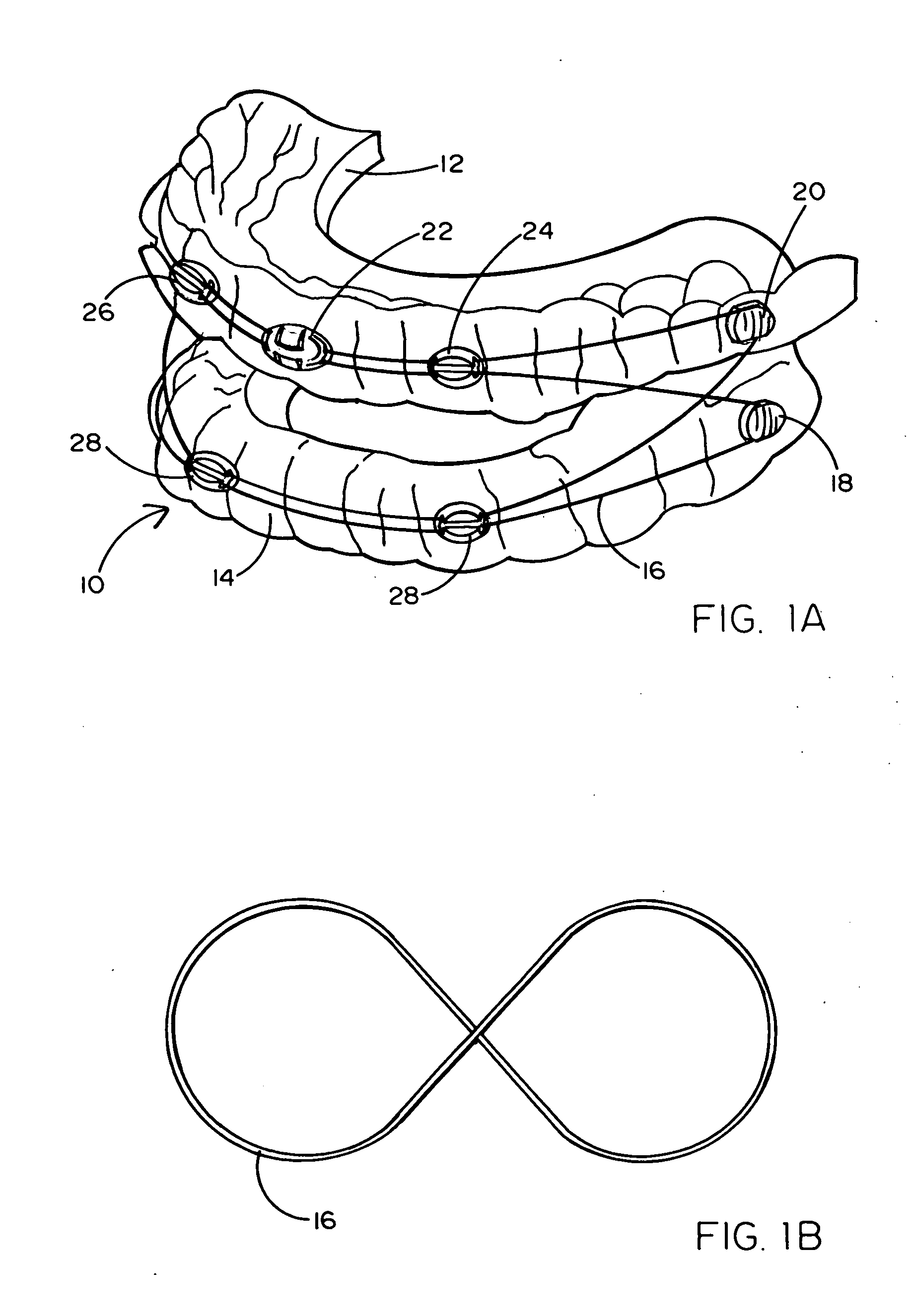 Adjustable oral appliance for treatment of snoring and sleep apnea