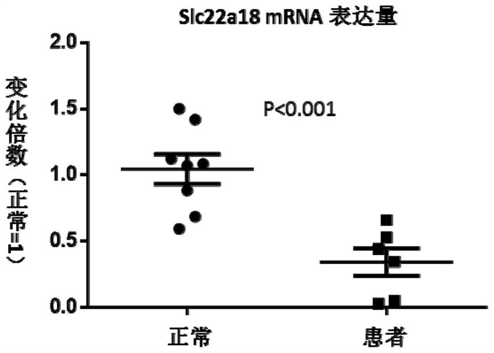 Gene slc22a18 affecting fat metabolism and growth and development in children