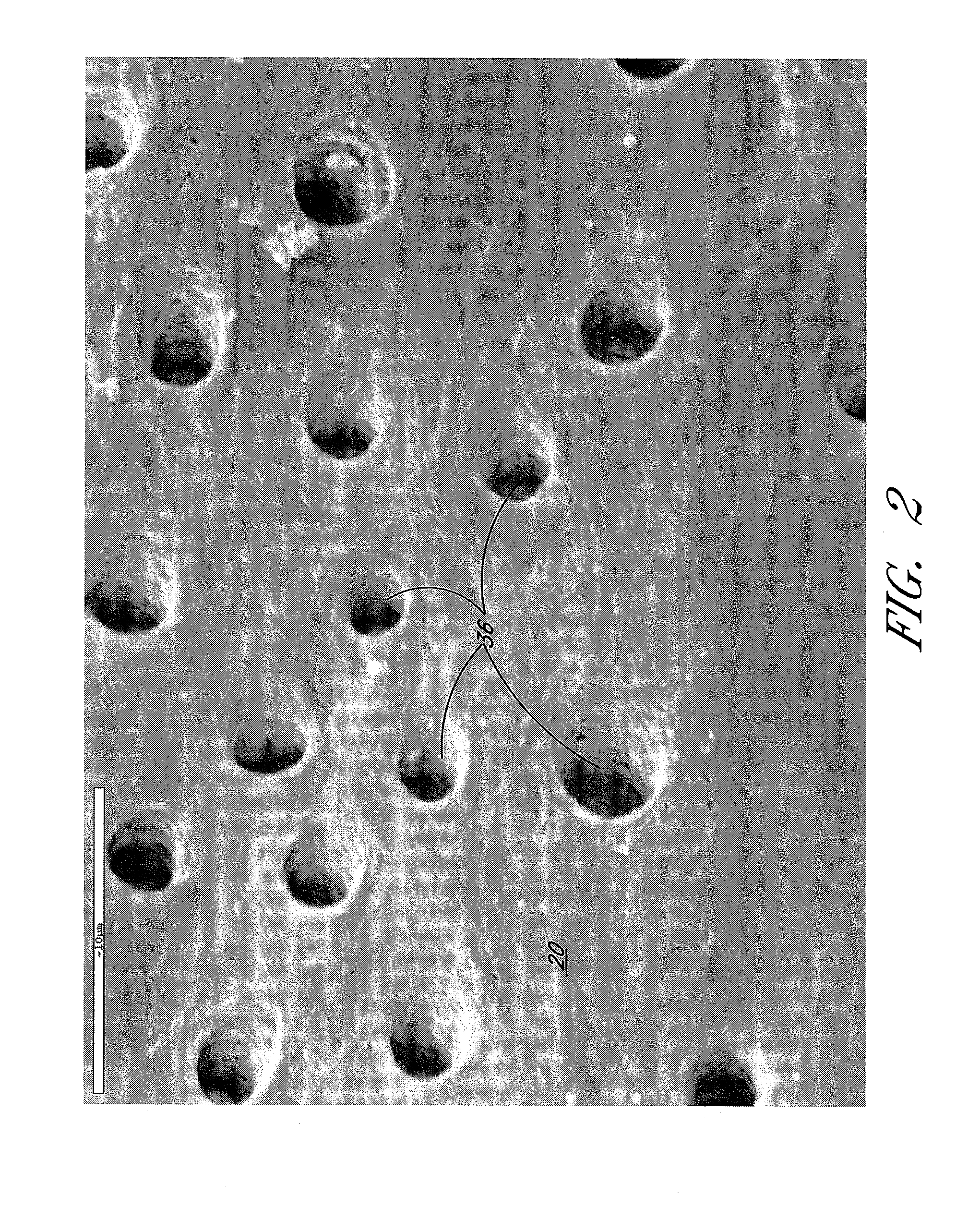Apparatus and methods for root canal treatments