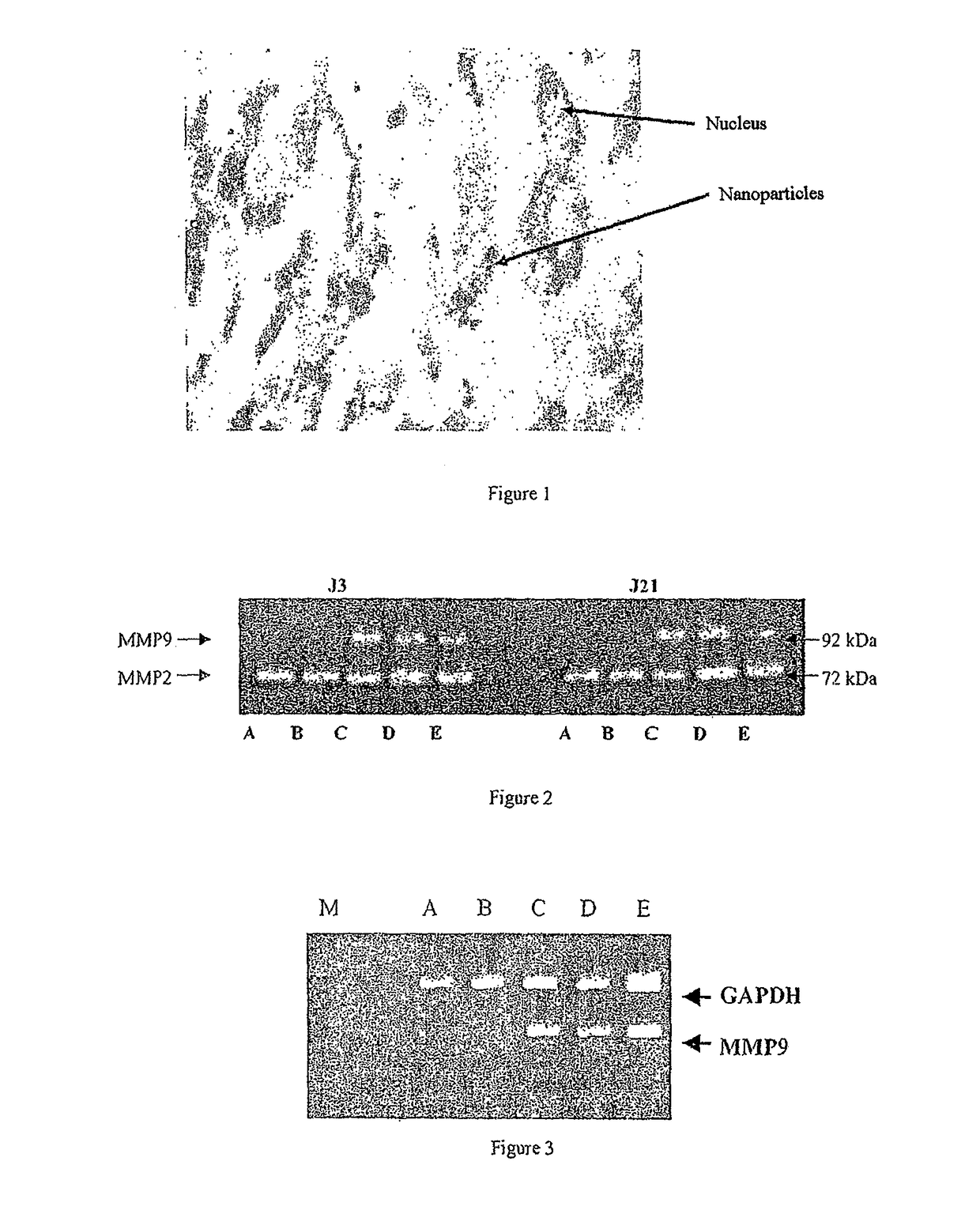 Use of gingival fibroblasts for vascular cell therapy