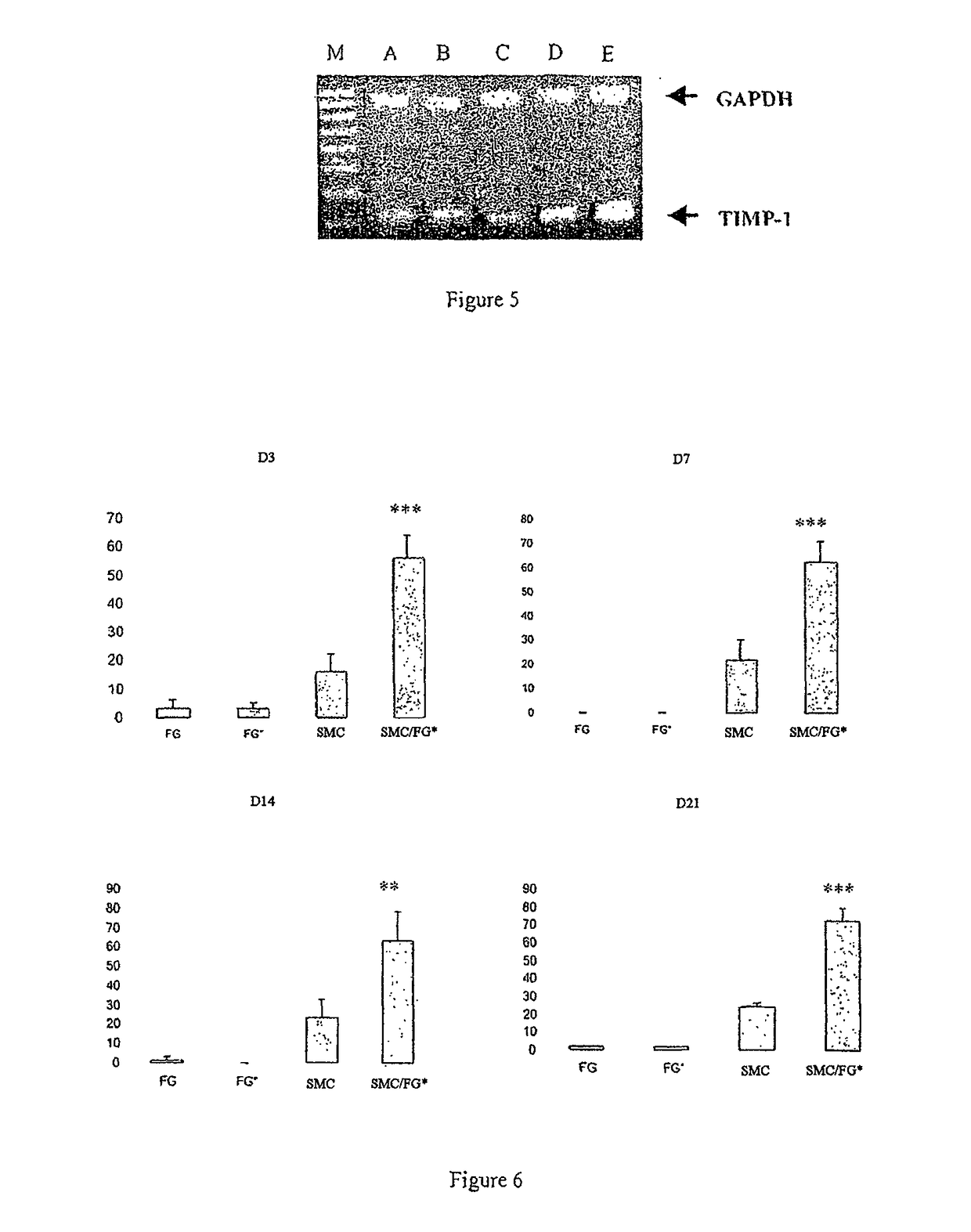 Use of gingival fibroblasts for vascular cell therapy