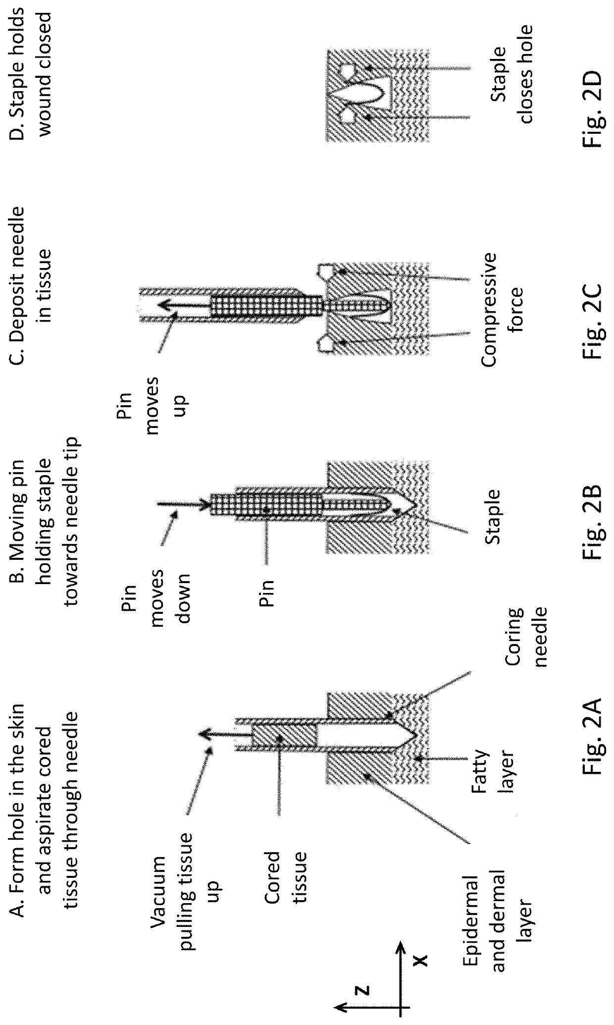Microclosures and related methods for skin treatment