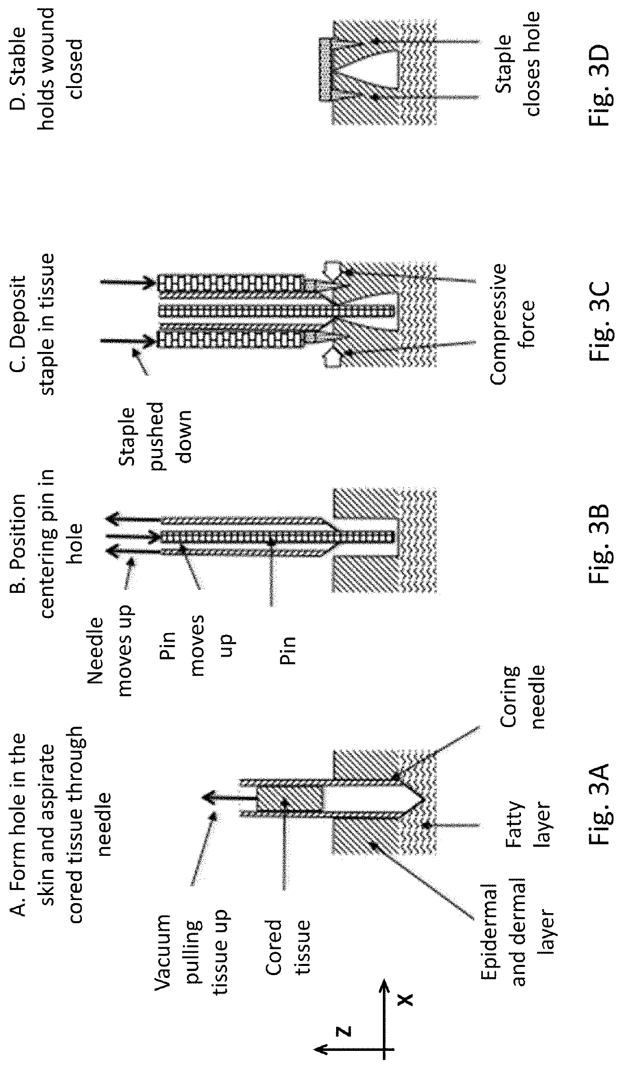 Microclosures and related methods for skin treatment