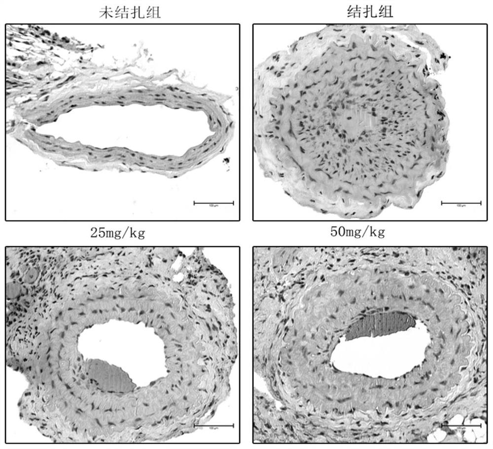 A kind of agonist of adenylate-activated protein kinase and its application