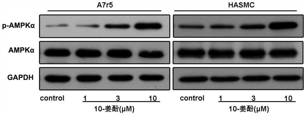 A kind of agonist of adenylate-activated protein kinase and its application