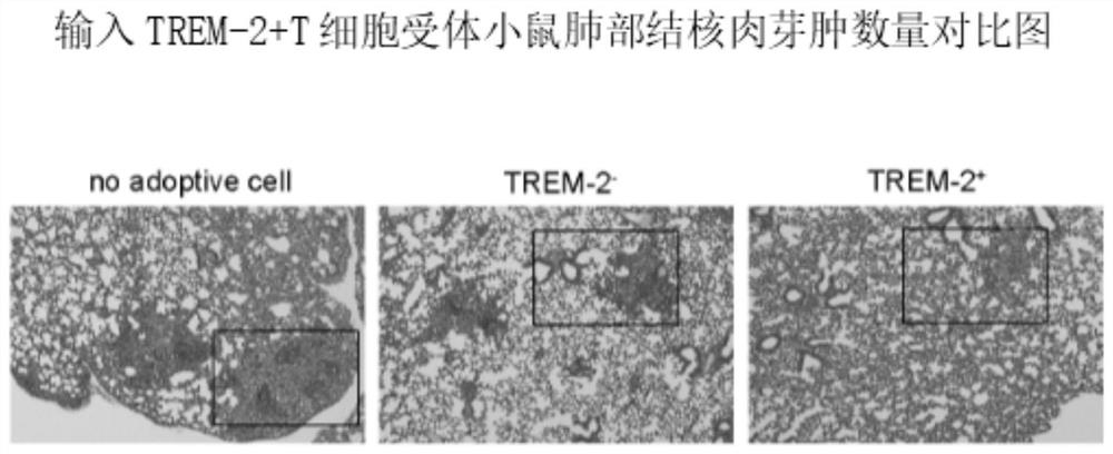 Application of trem-2+t cells in preparation of drugs for treating tuberculosis