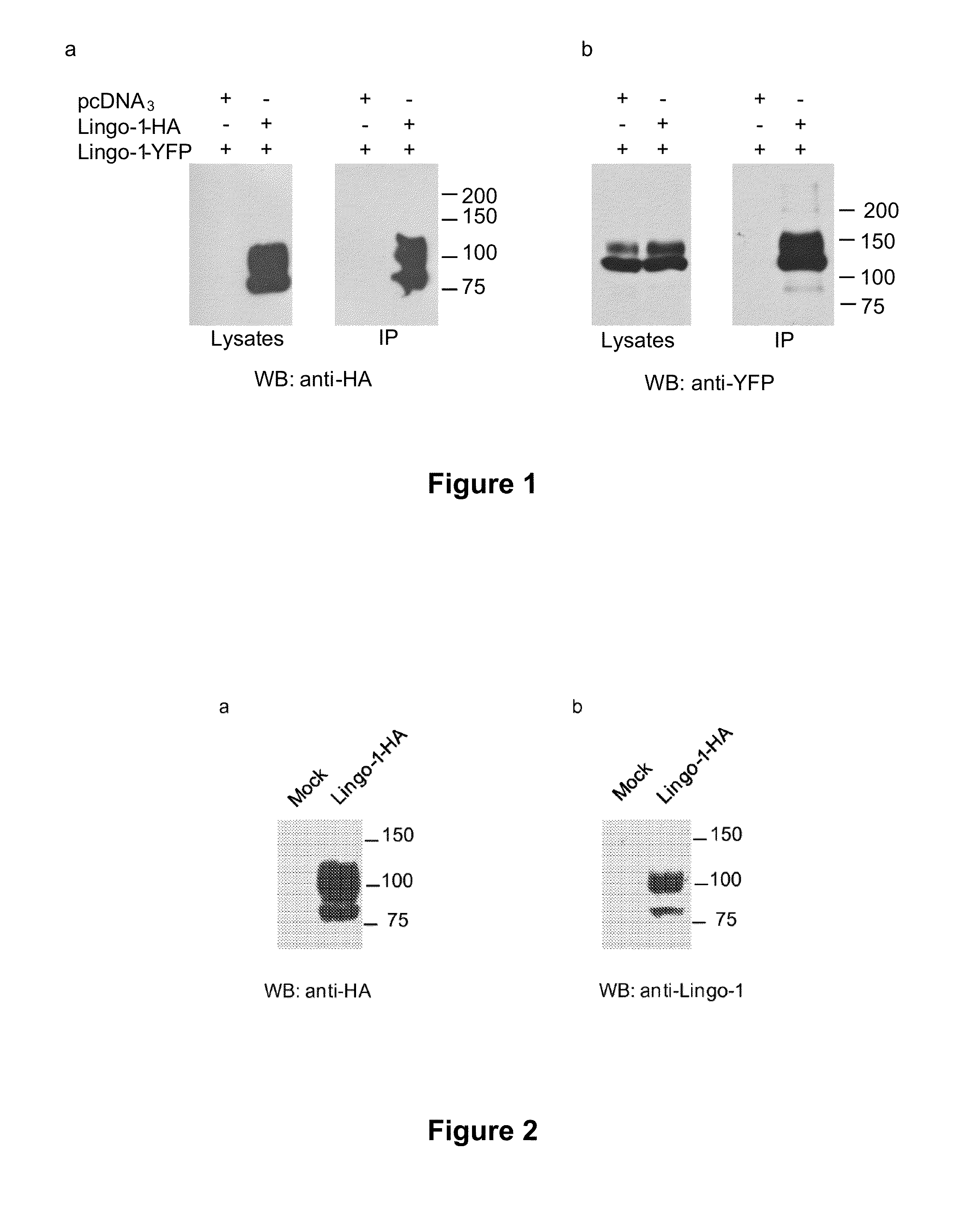 Tools for the identification of lingo-1, lingo-2, lingo-3 and lingo-4 ligands, and uses thereof