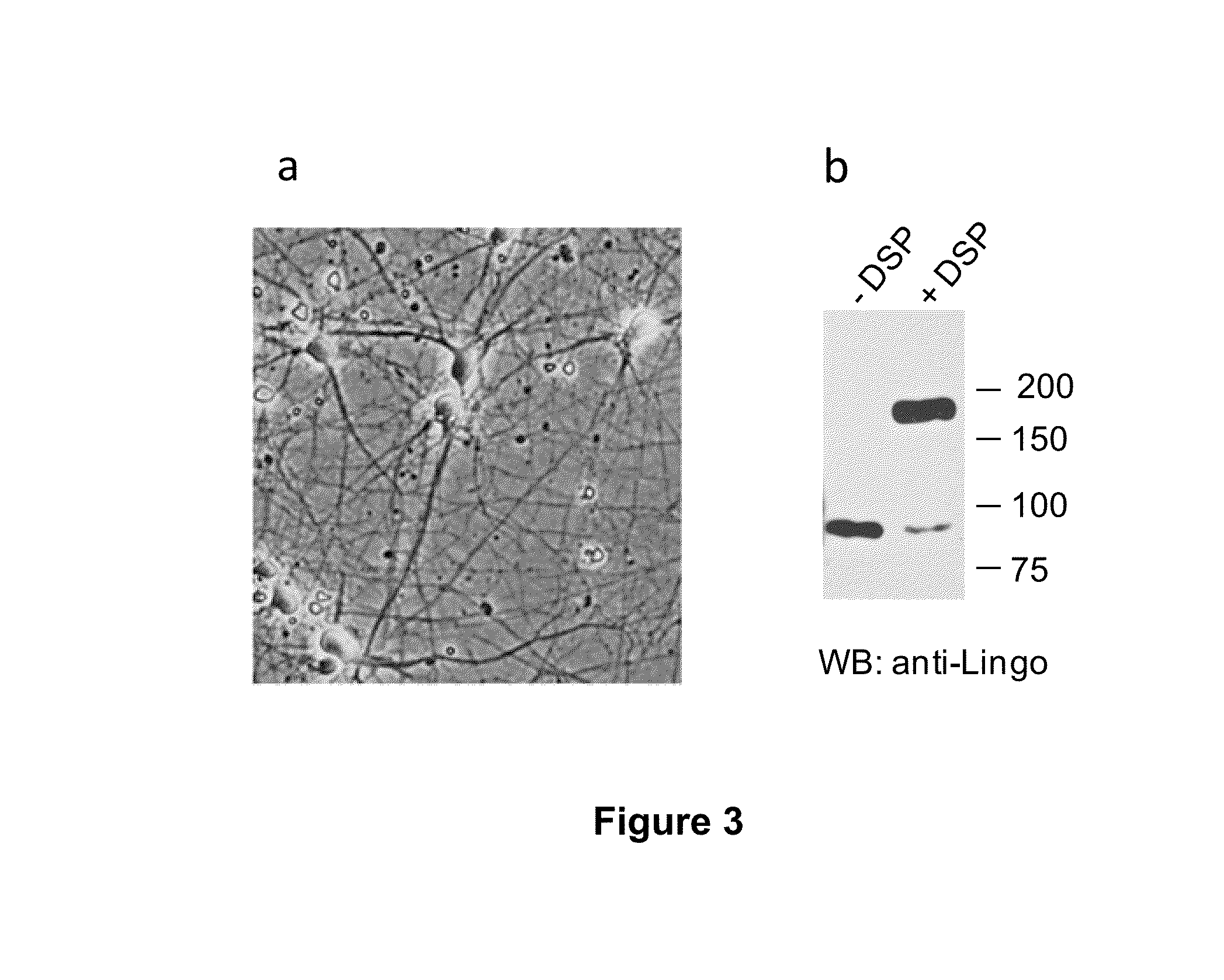 Tools for the identification of lingo-1, lingo-2, lingo-3 and lingo-4 ligands, and uses thereof