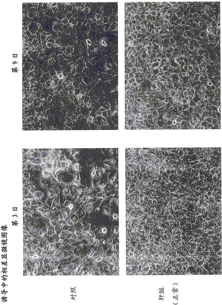 Method for inducing differentiation of induced pluripotent stem cells and method for selecting induced pluripotent stem cells