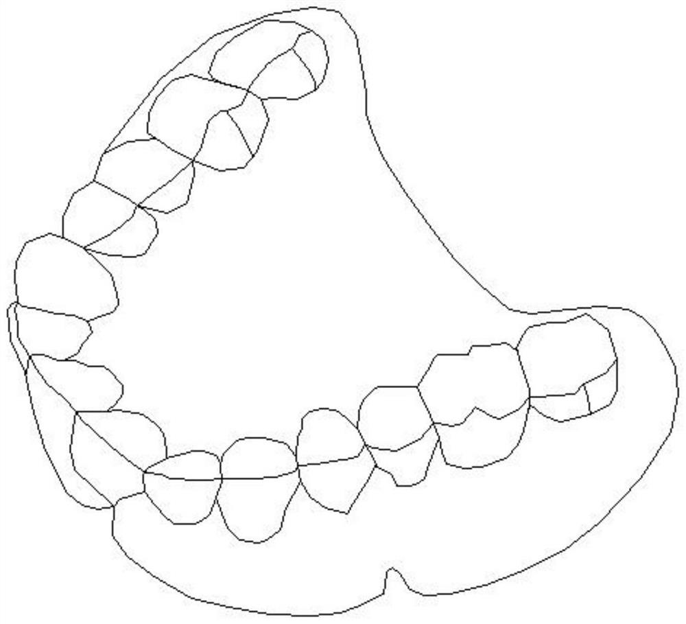 Complete removable denture resin block and digital complete removable denture manufacturing method