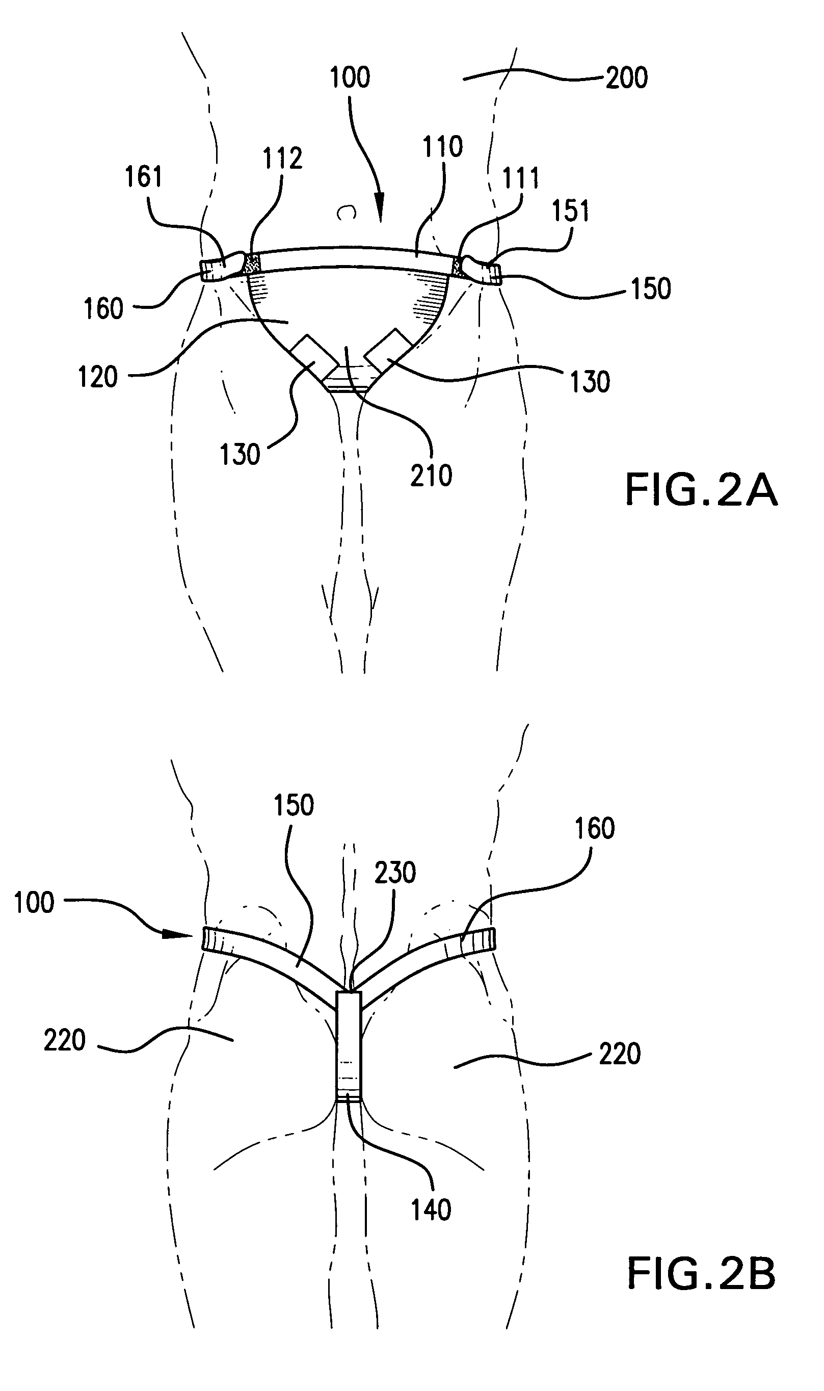 Methods and apparati for the close application of therapeutic and other devices to the pelvic area