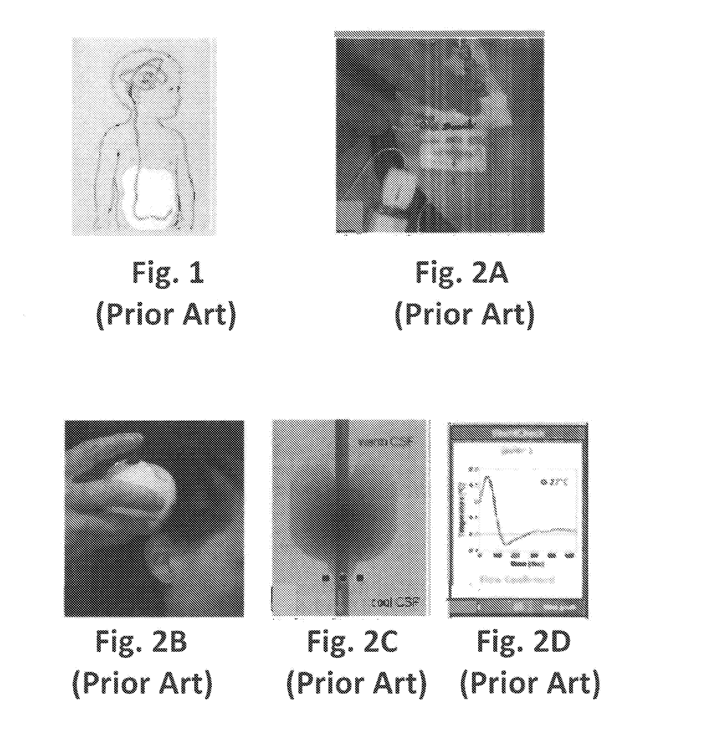 Continuous real-time CSF flow monitor and method