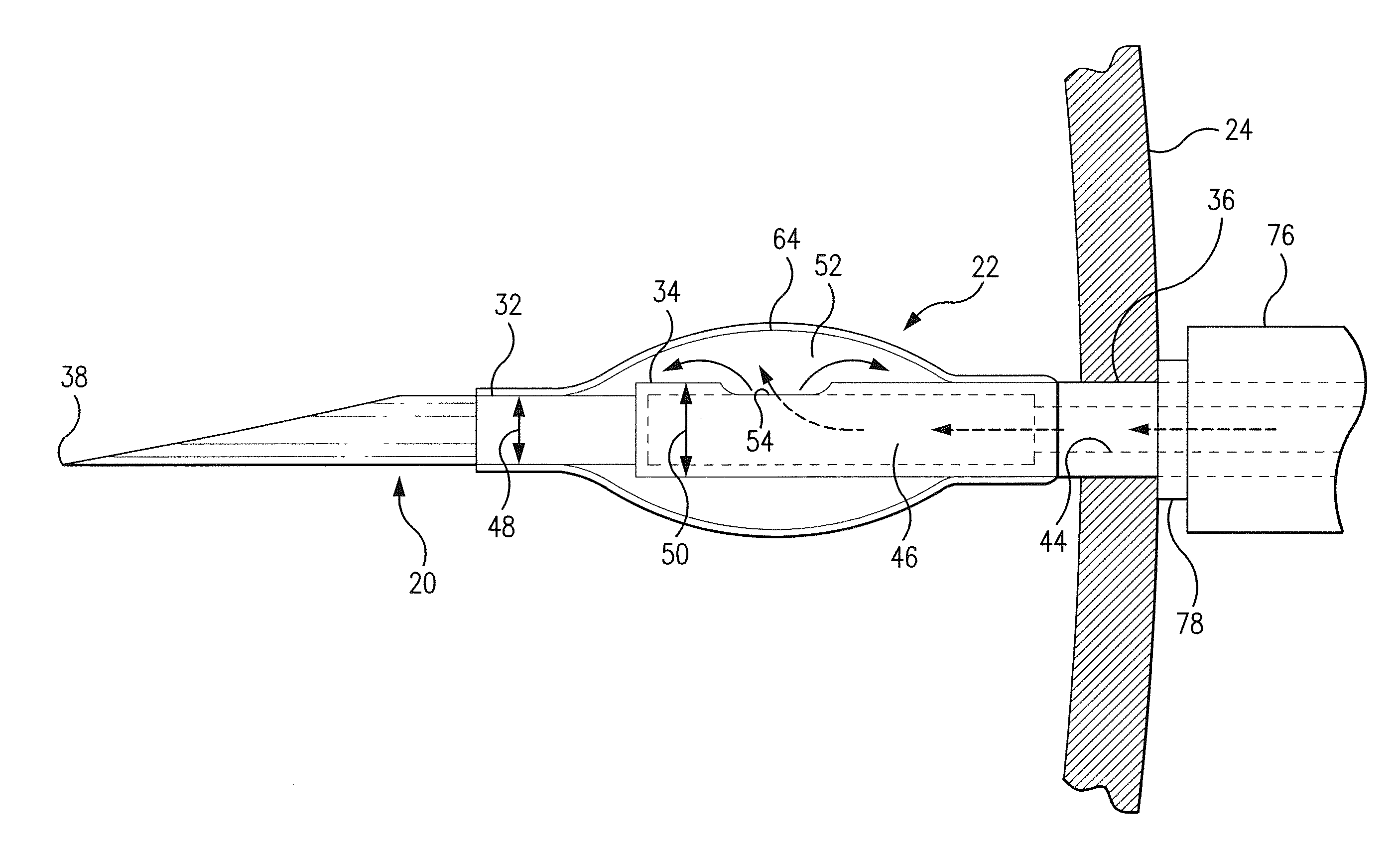 Bioresorbable drug eluting intravitreal implant system and method