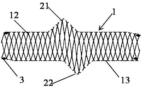 Intravascular stent with developing function